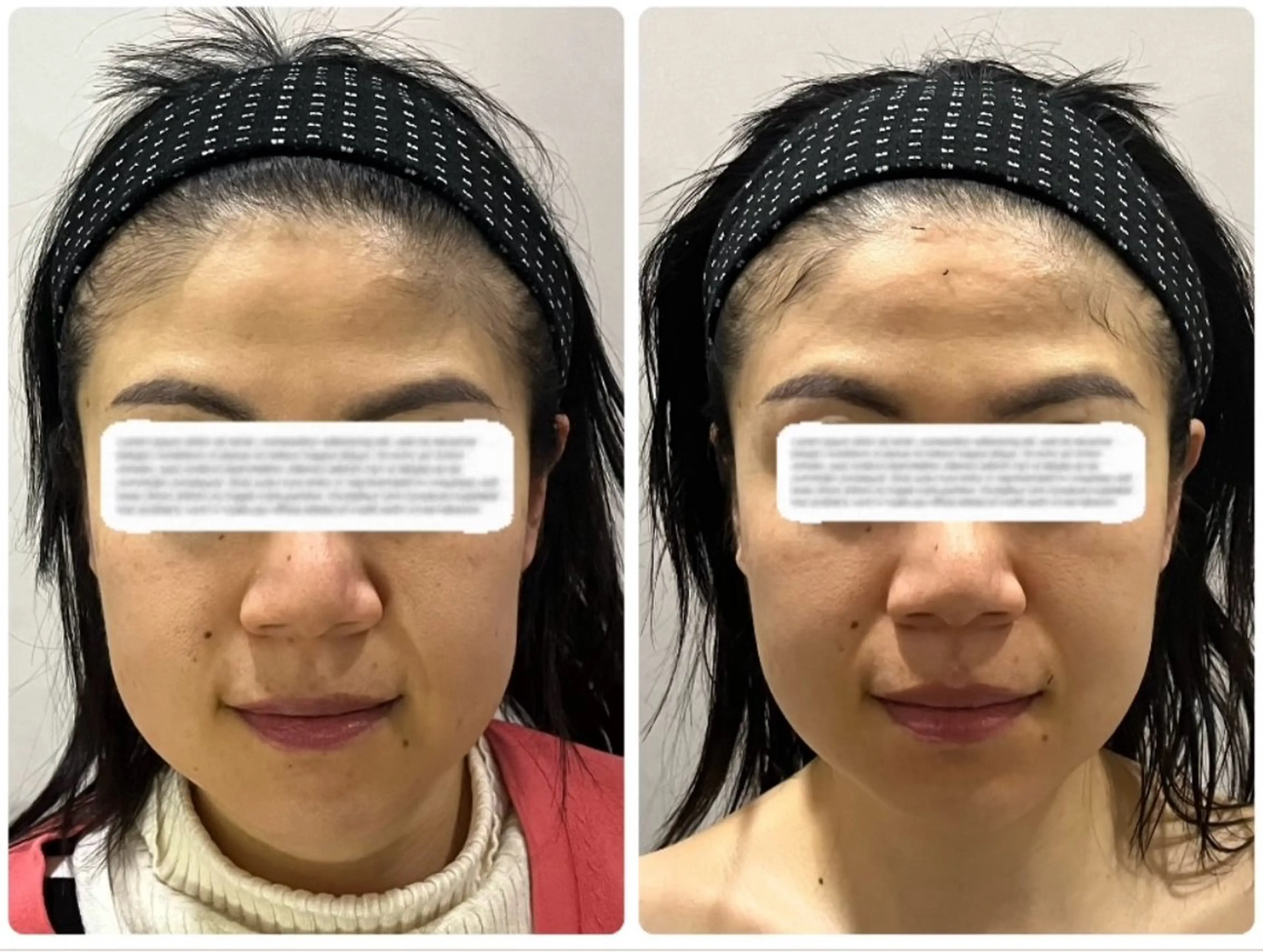 エステ リラク mi yuのエステ・リラクイメージ