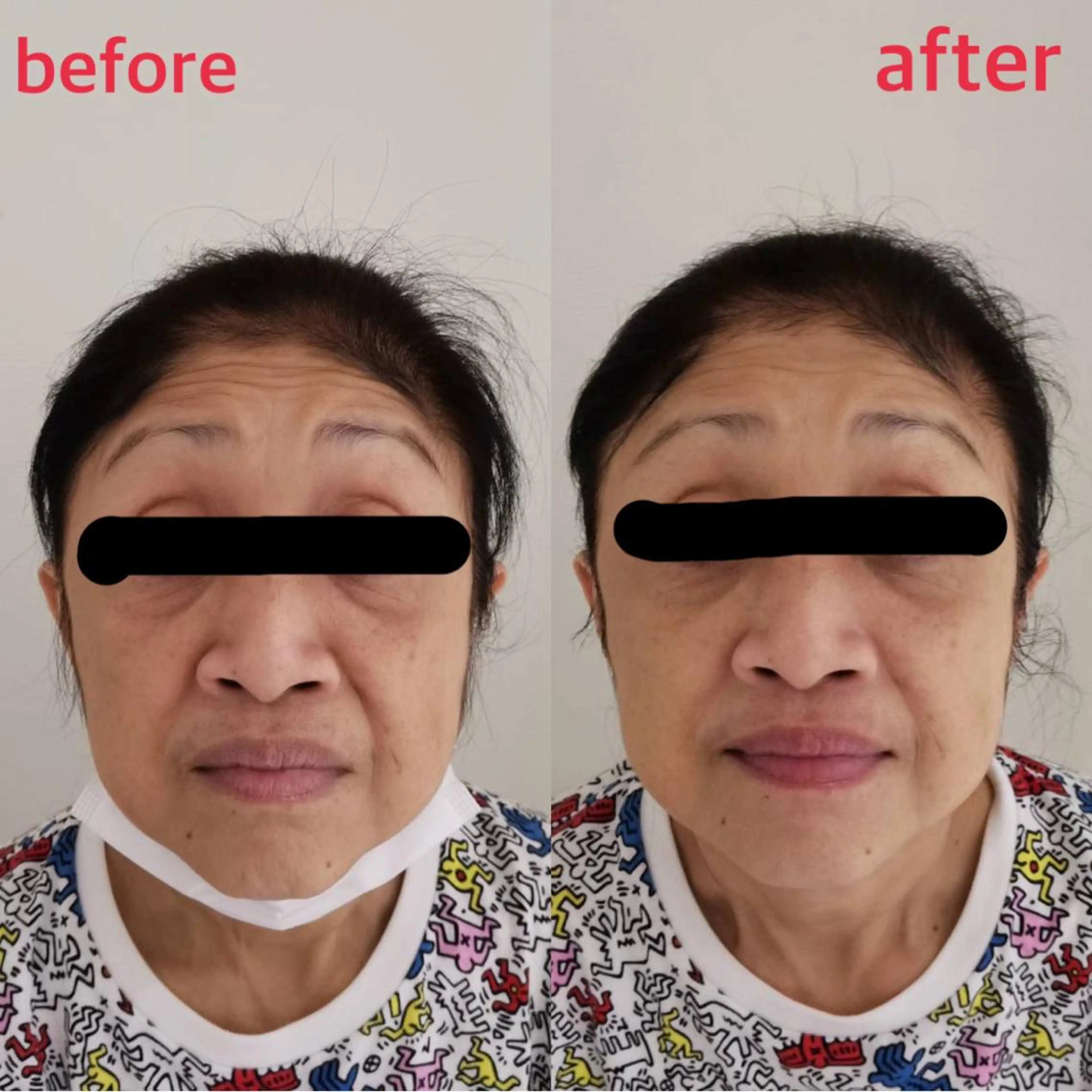 小顔・ツルツル素肌 ハリステリアのエステ・リラクイメージ