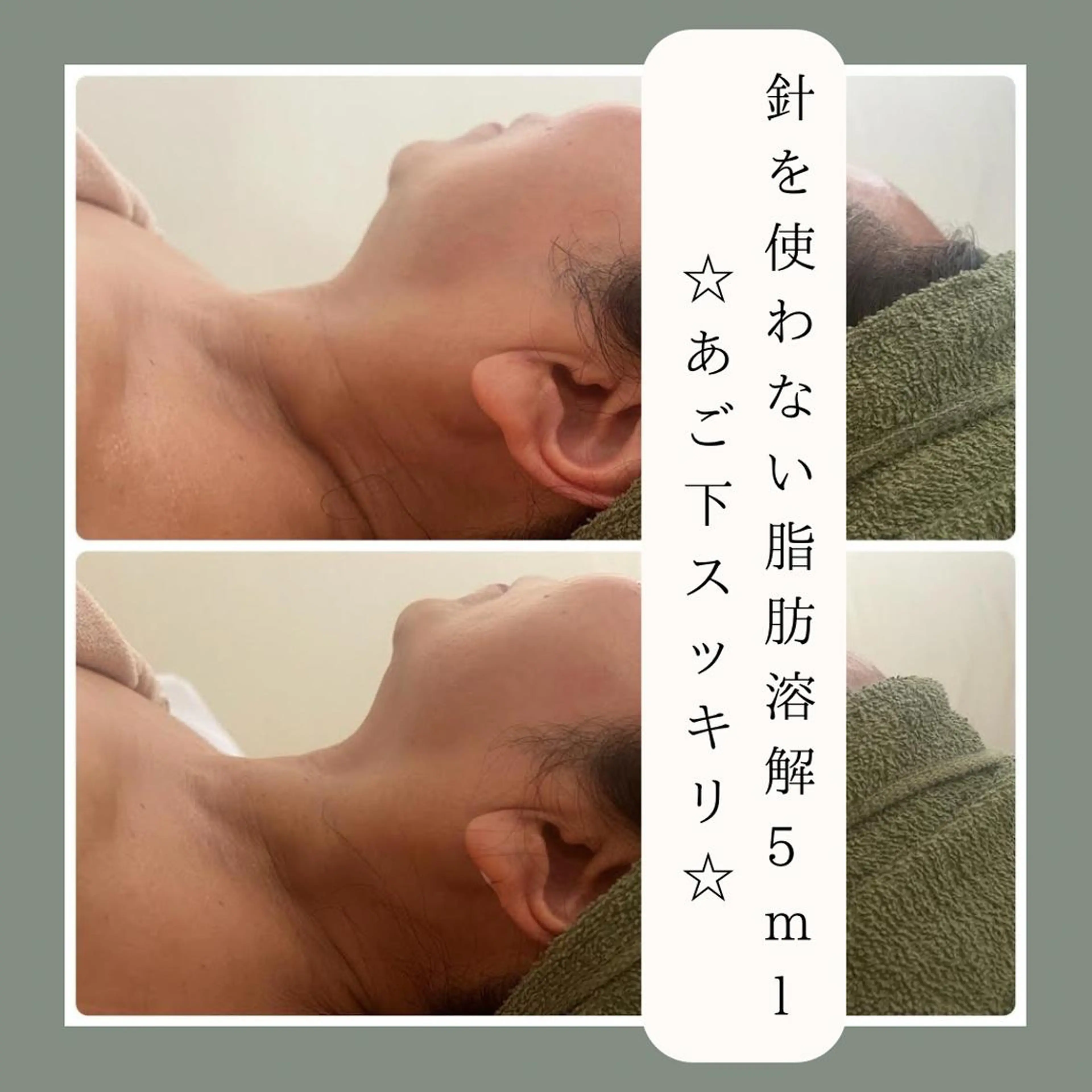 大阪市初！男性もok 酵素浴/痩身/小顔のその他イメージ