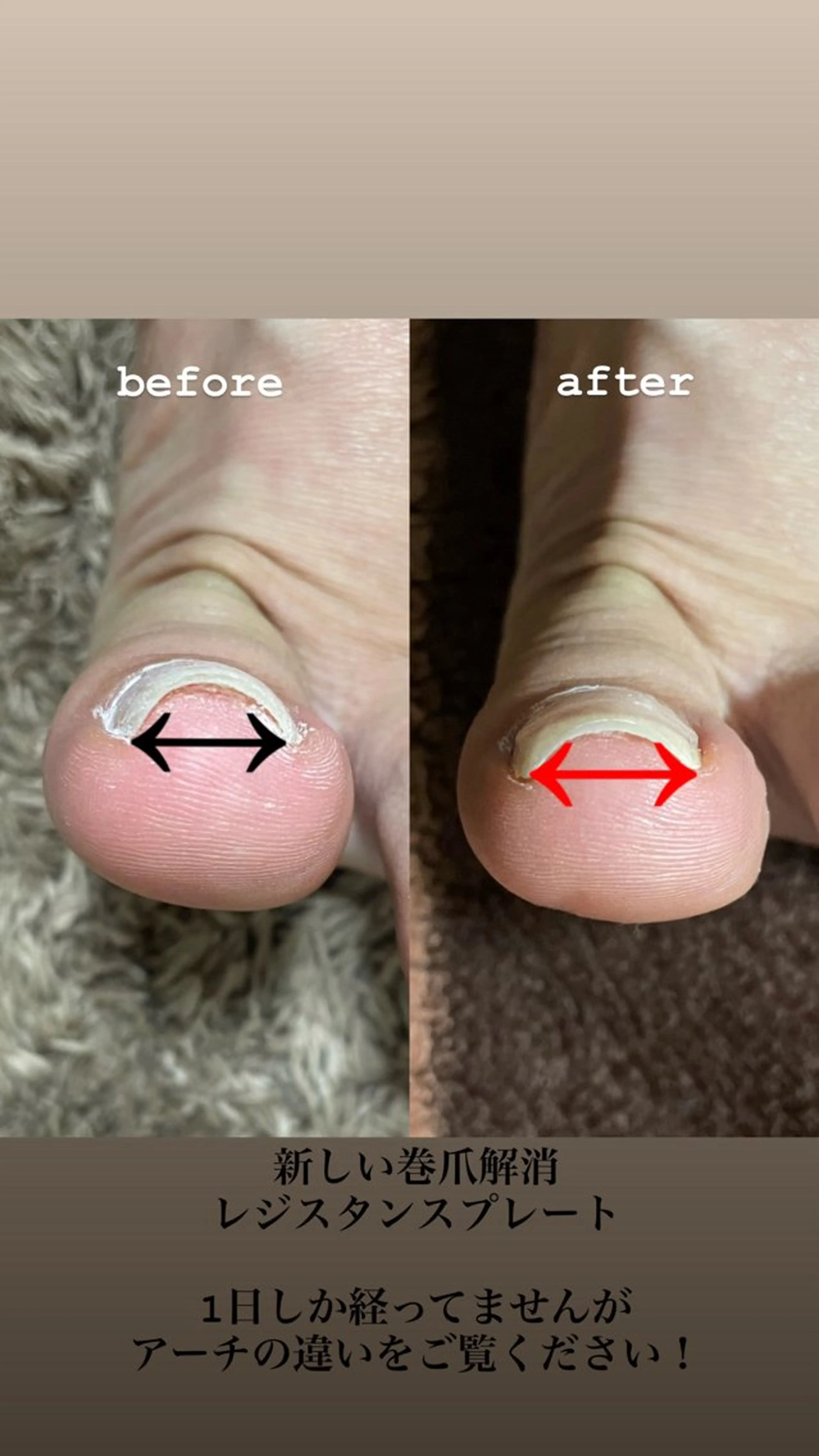 ネイル その他 Estotibi エストティビのその他イメージ