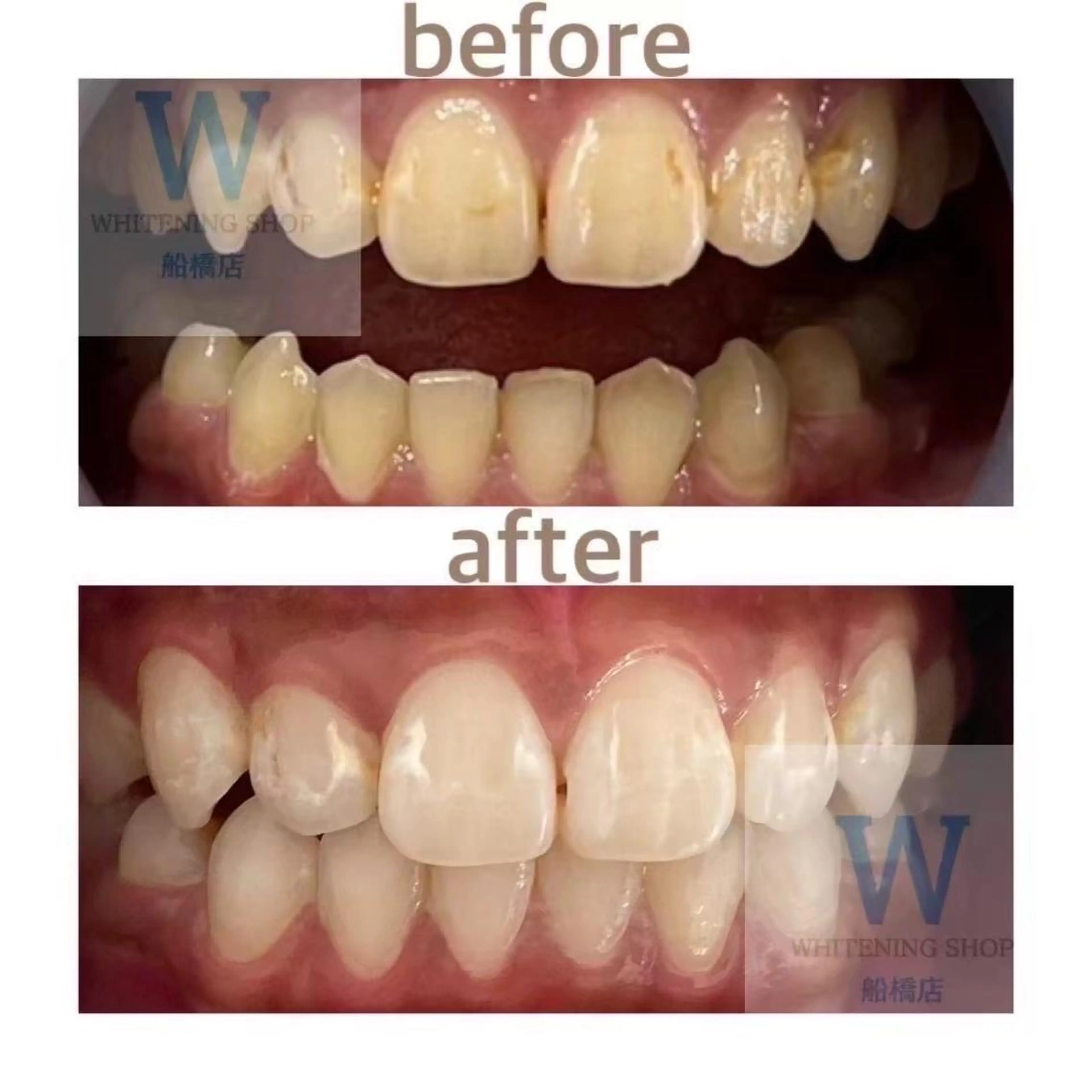 エステ リラク ホワイトニング ショップ船橋店🦷のエステ・リラクイメージ