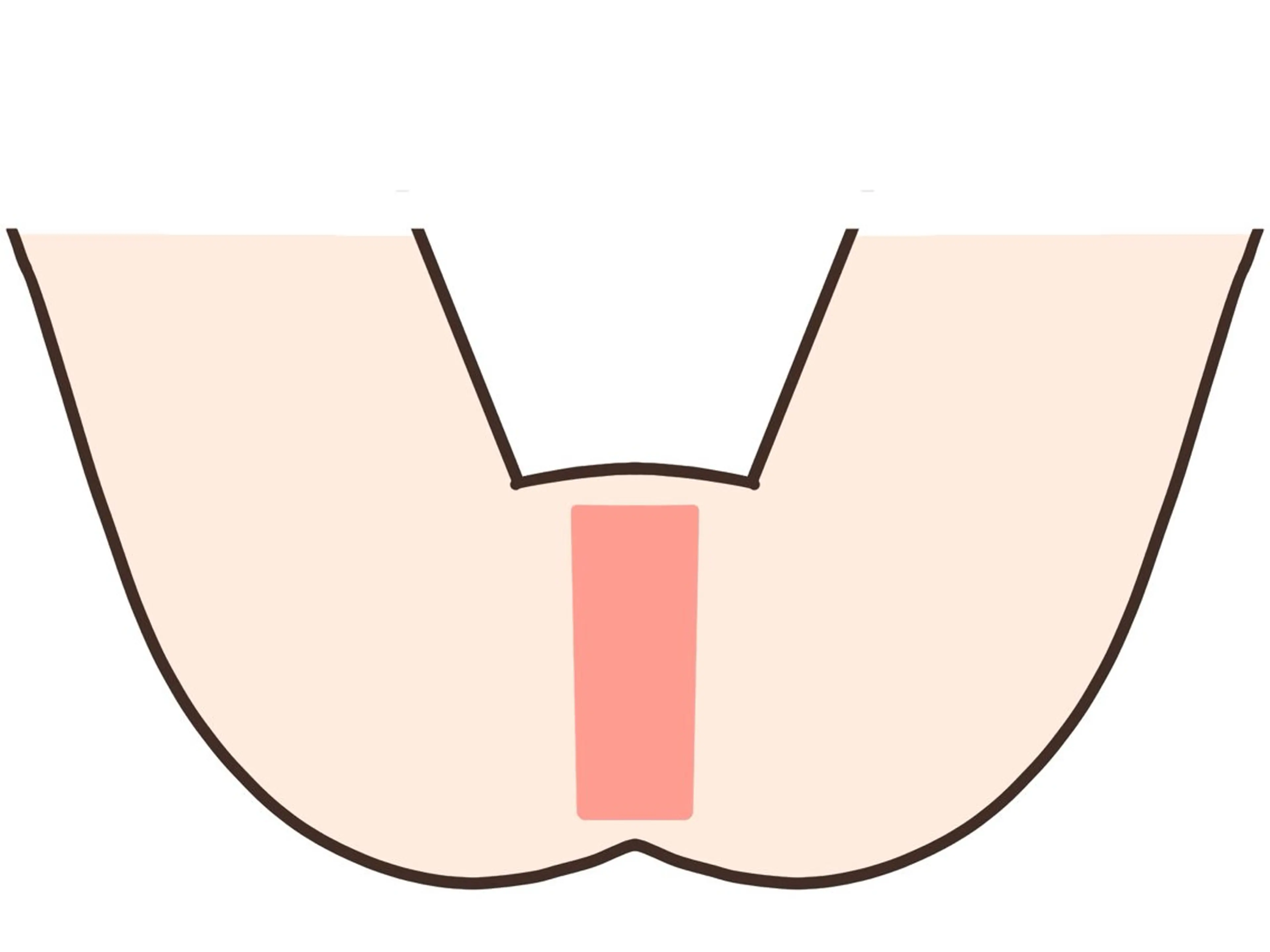 【レディース】VIO選べる部位ワックス脱毛『I』/はみ毛防止・完全ノーヘアデザイン可能！毛量により割引き制度あり◎の写真