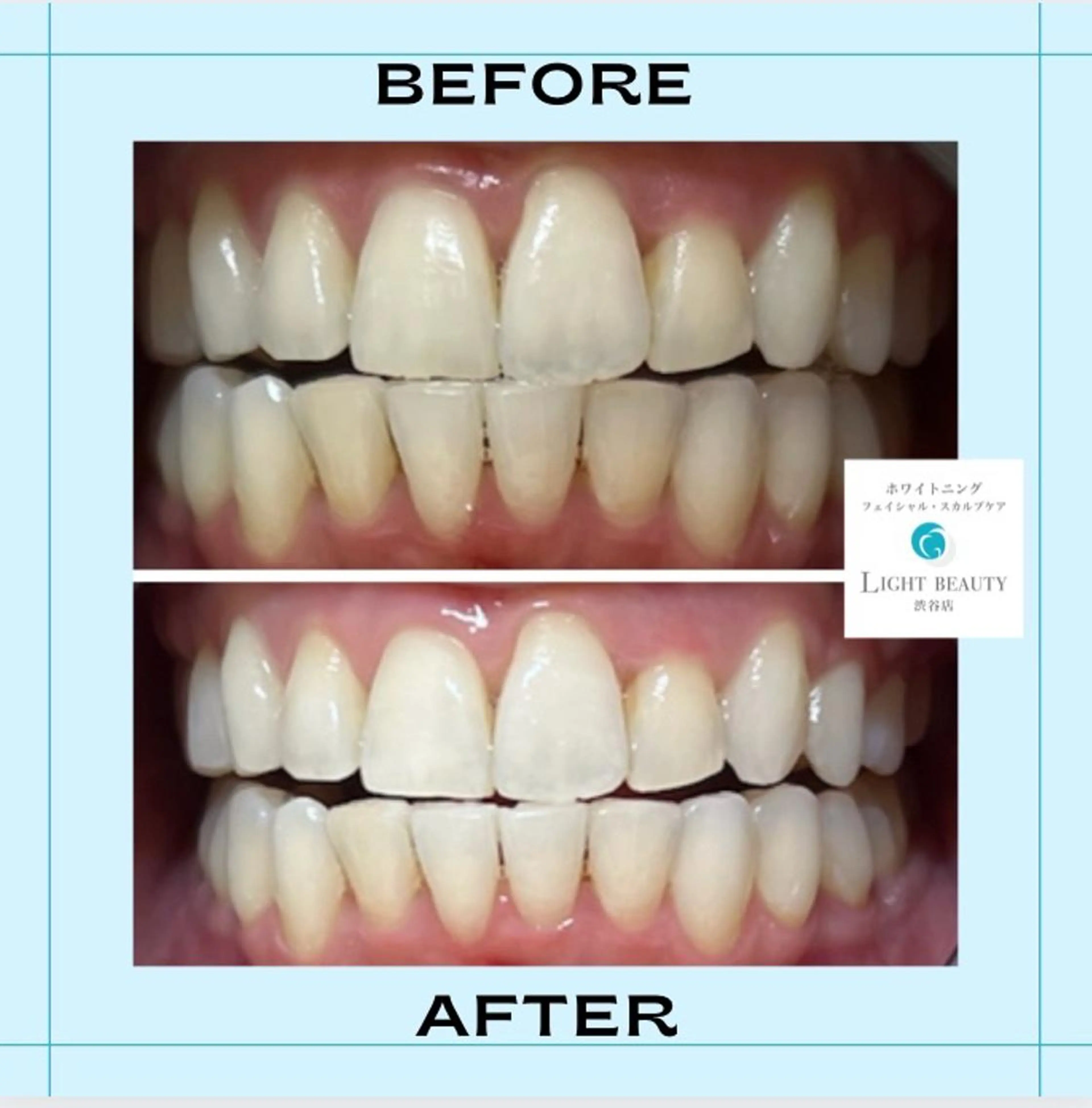 ライトビューティー渋谷本店所属・ライトビューティー 渋谷本店のその他イメージ