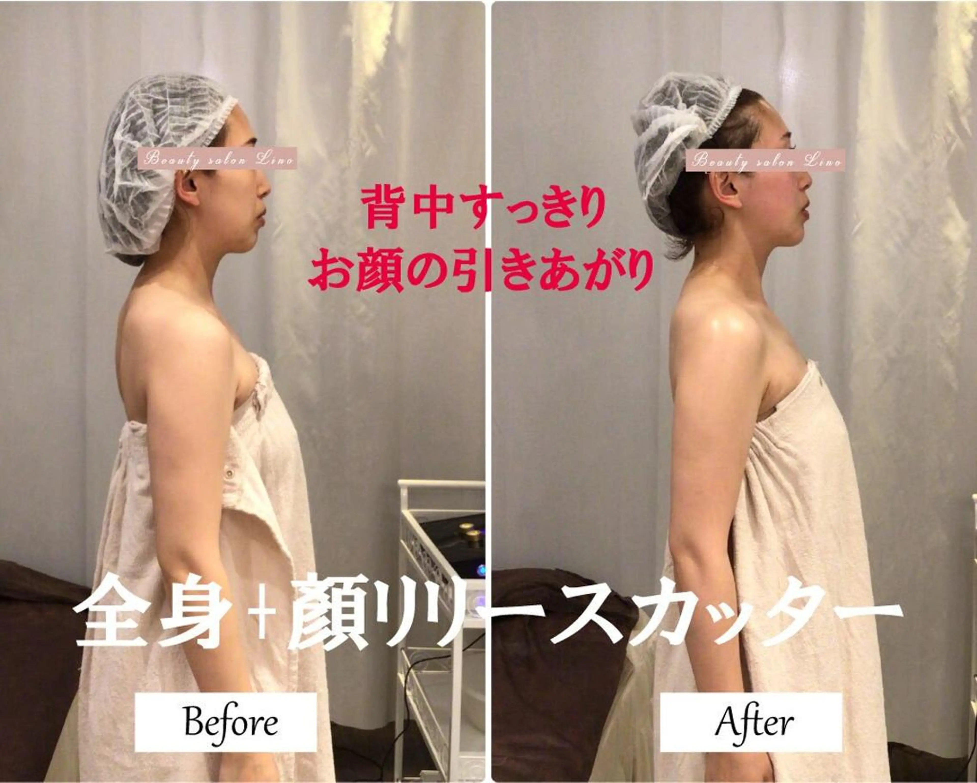 ブライダルサロン ｜Lino【堀江】のエステ・リラクイメージ