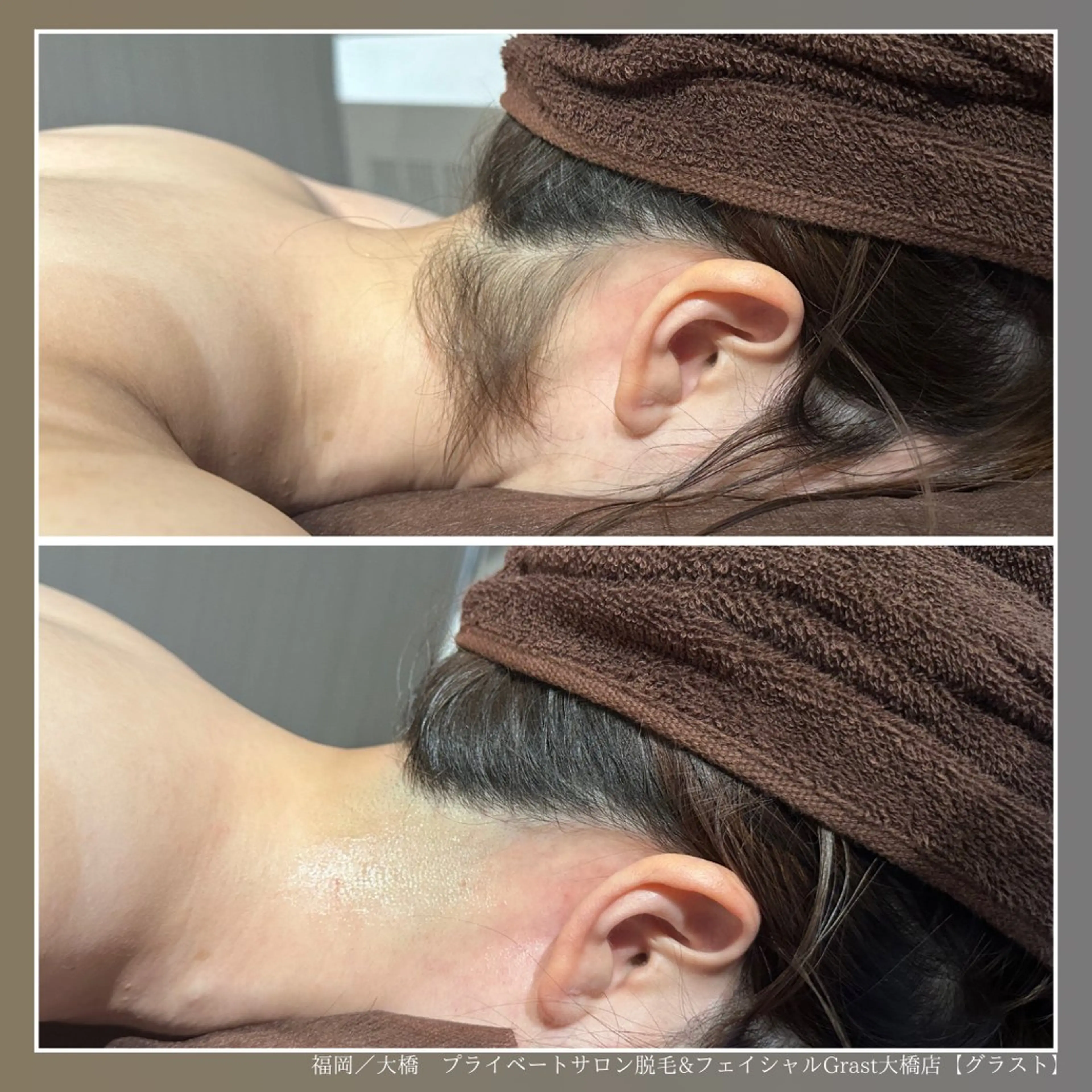 脱毛 プライベートサロン Grast🪴アイカのエステ・リラクイメージ