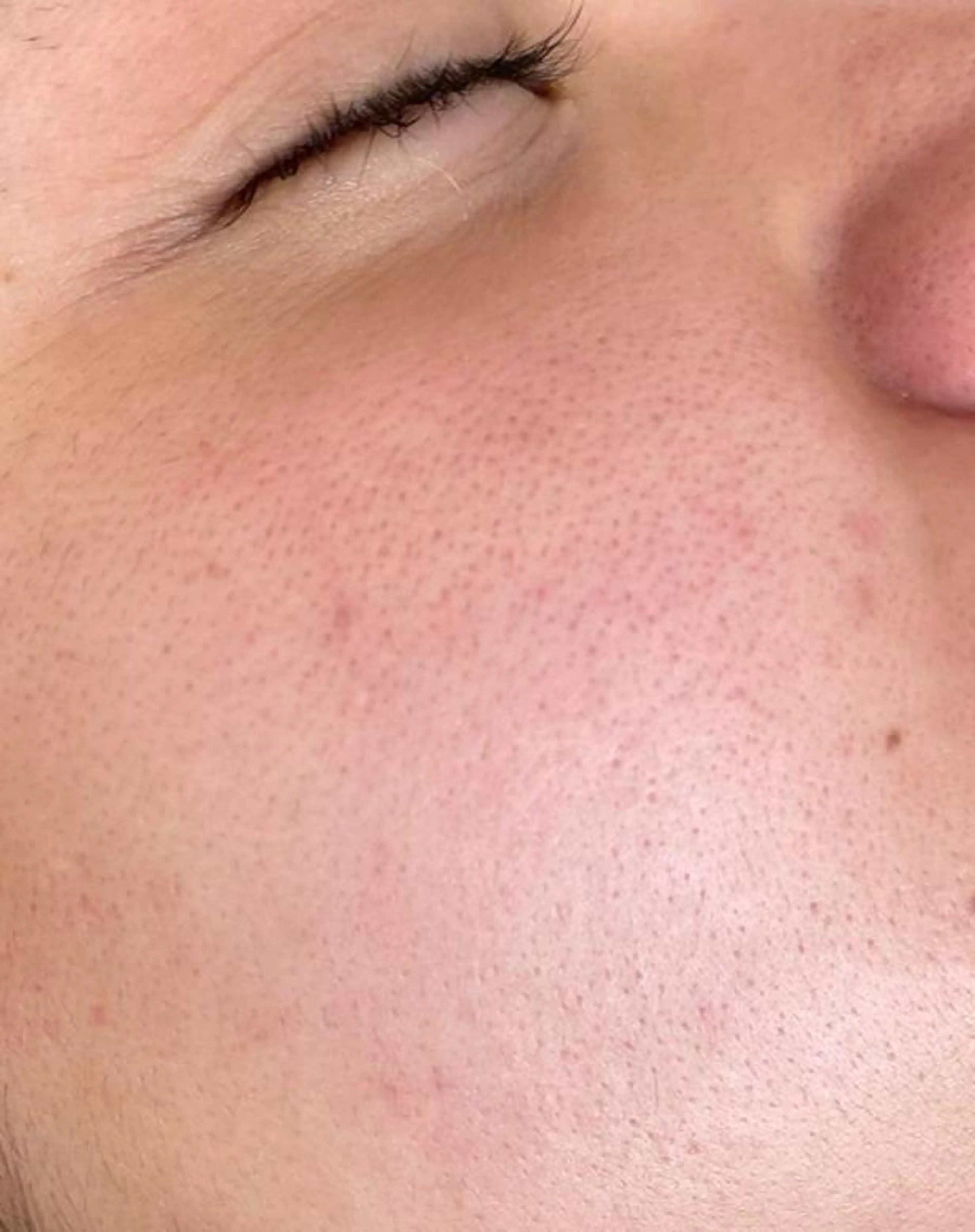 ADDICT中目黒店所属・毛穴洗浄/毛穴ケア 🌿中目黒🌿のエステ・リラクイメージ