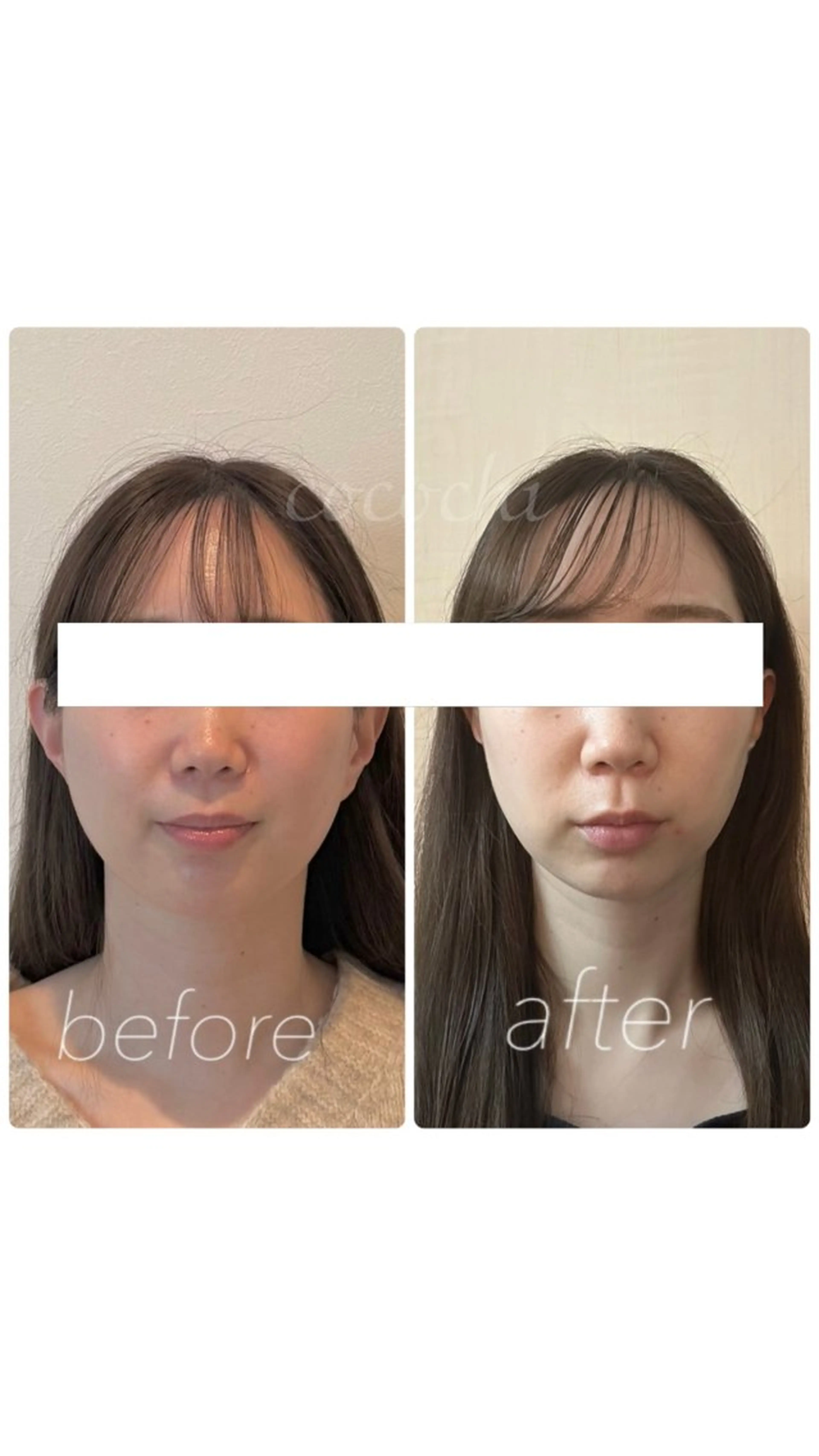 エステ リラク 小顔と ヘッドスパのお店のエステ・リラクイメージ