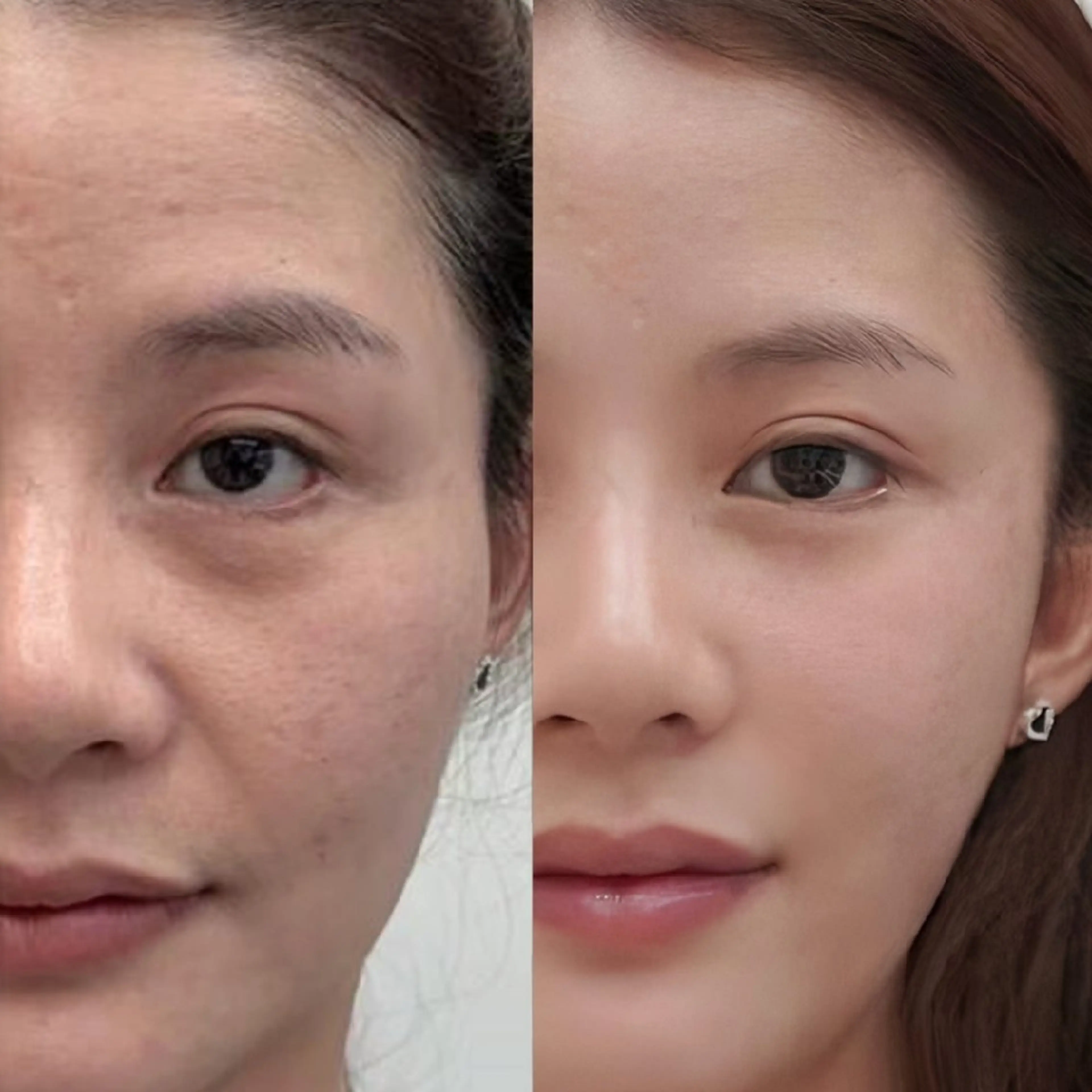 エステ aliaハイフ&水光ジェットサロン所属・aliaハーブ水光店 エステティシャン募集のエステ・リラクイメージ