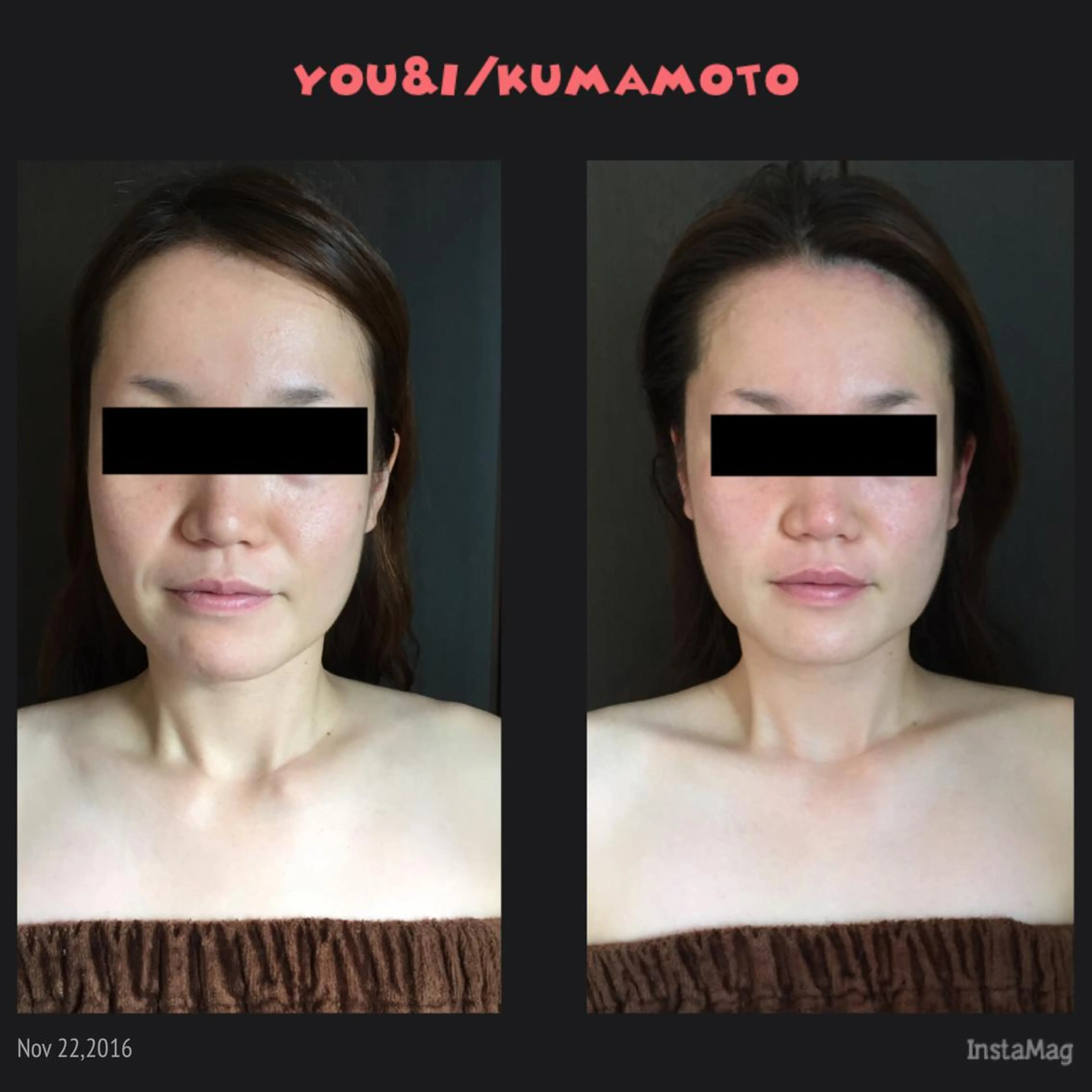 キッズ マツエク・マツパ You&i(ユーアイ)所属・Nomura Suuのエステ・リラクイメージ