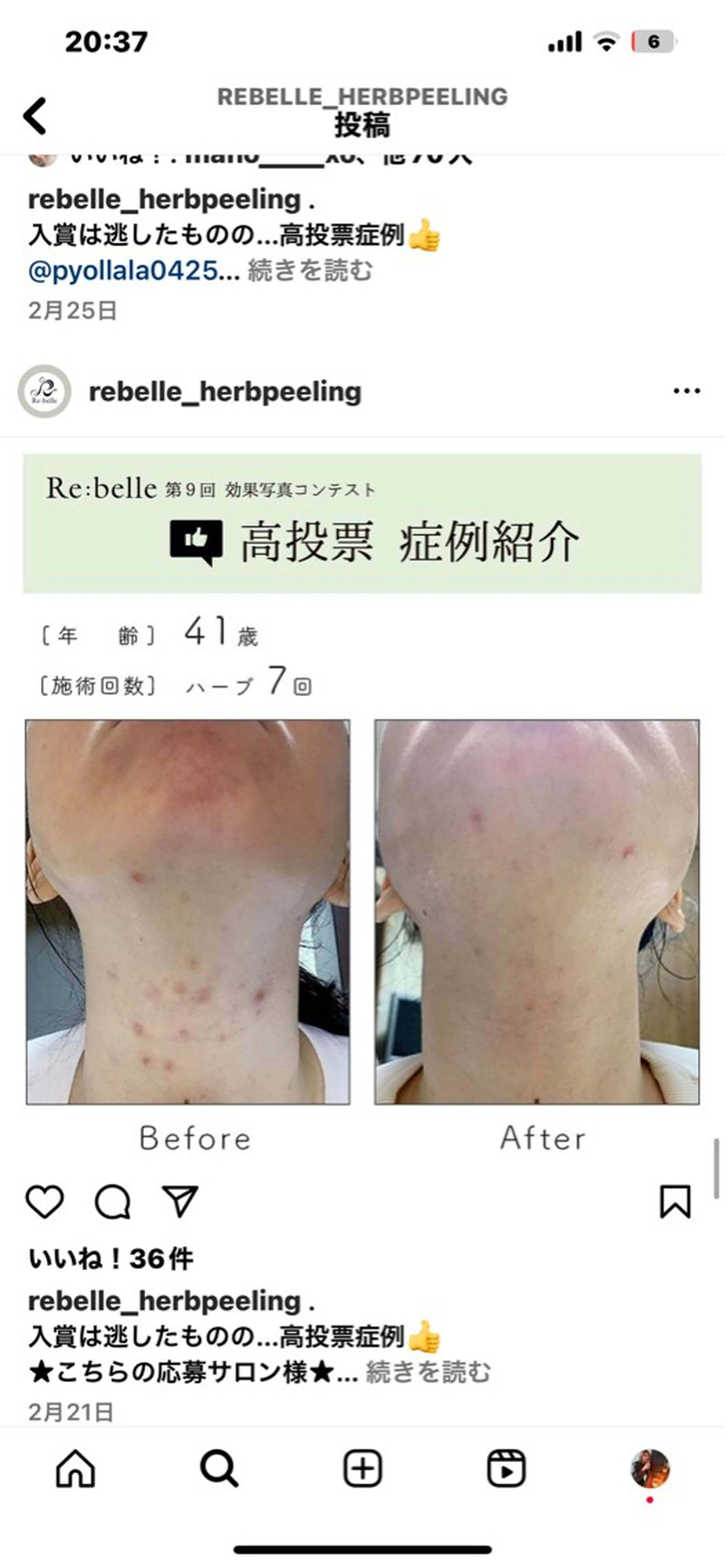 Liberte リベルテ(トモ化粧品店内)所属・RINA 🍒のマツエク・マツパデザイン