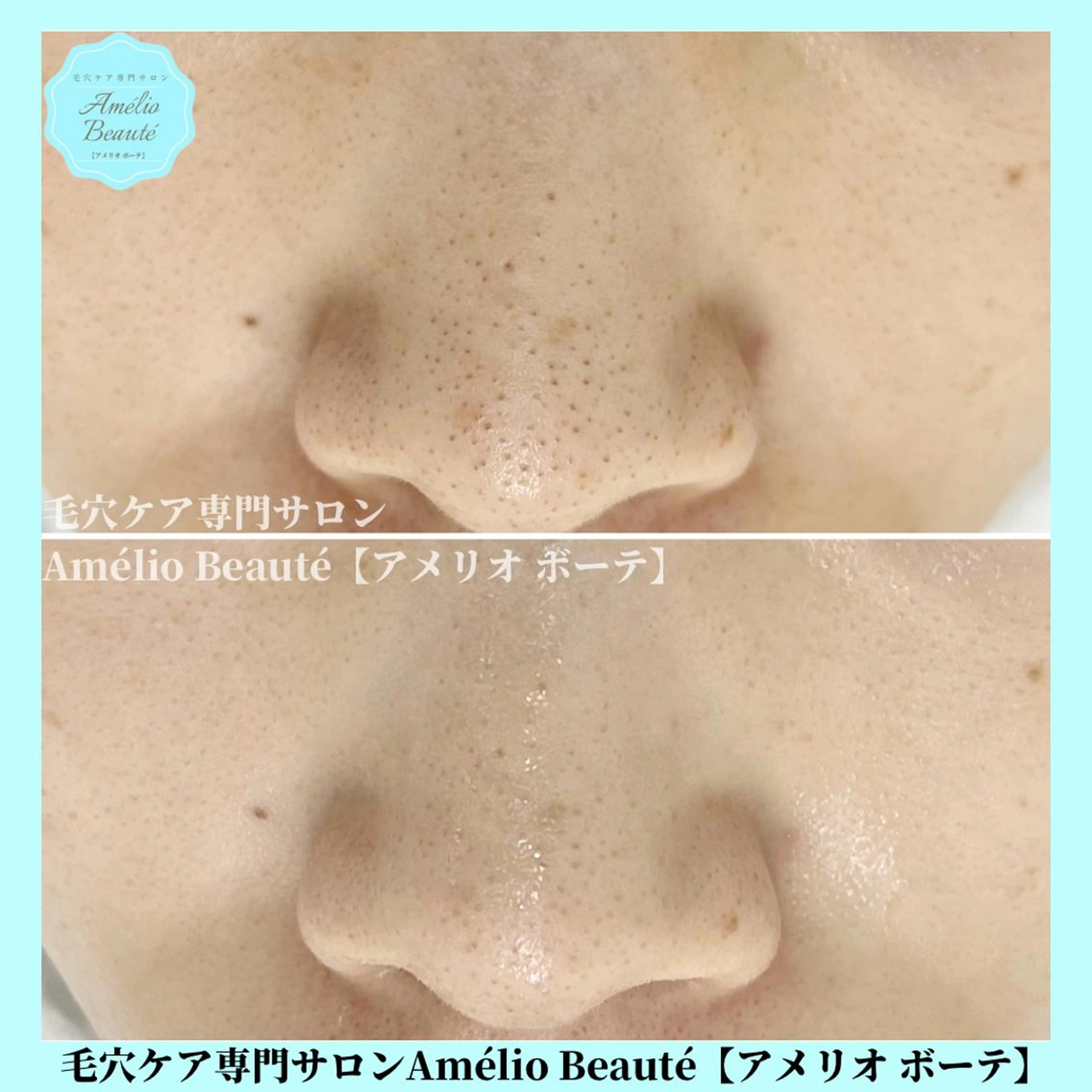 毛穴ケア専門サロン Amélio Beauté所属・毛穴ケア専門サロン アメリオボーテのその他イメージ