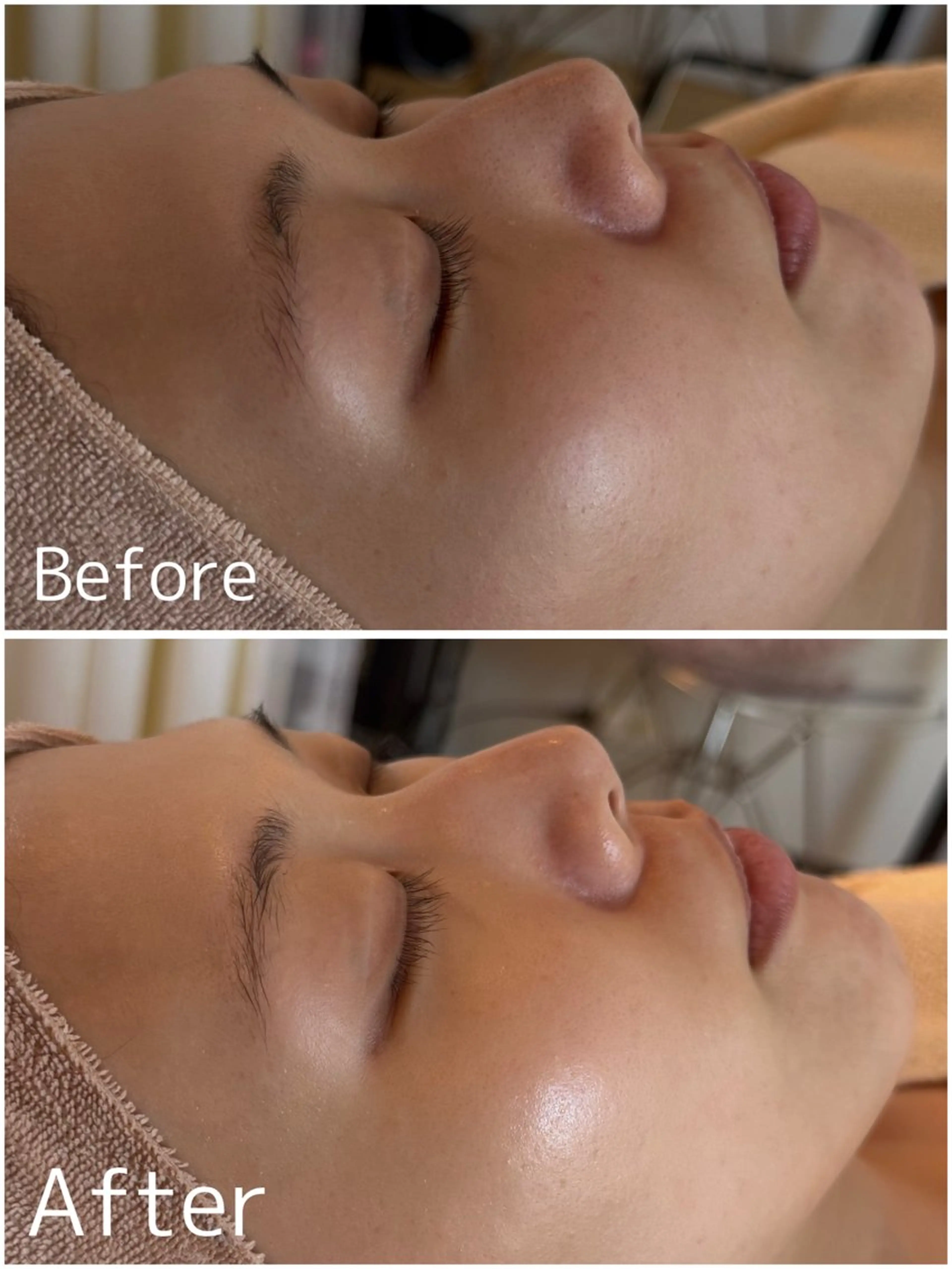 MiEL total beauty salon所属・脱毛サロン MiELのエステ・リラクイメージ