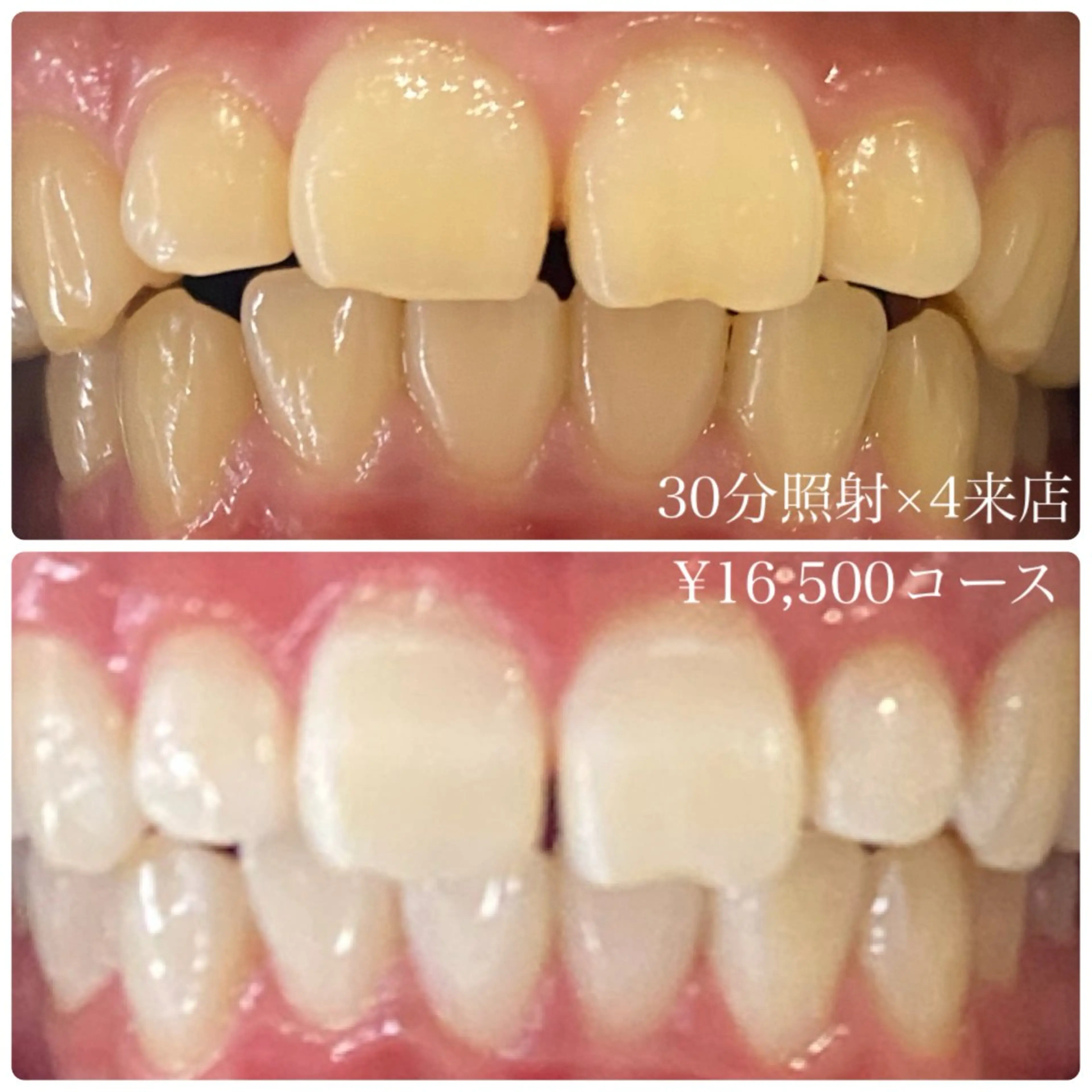 メンズ その他 ホワイトニングルーム　川崎店所属・ホワイトニング ルーム　川崎店のその他イメージ