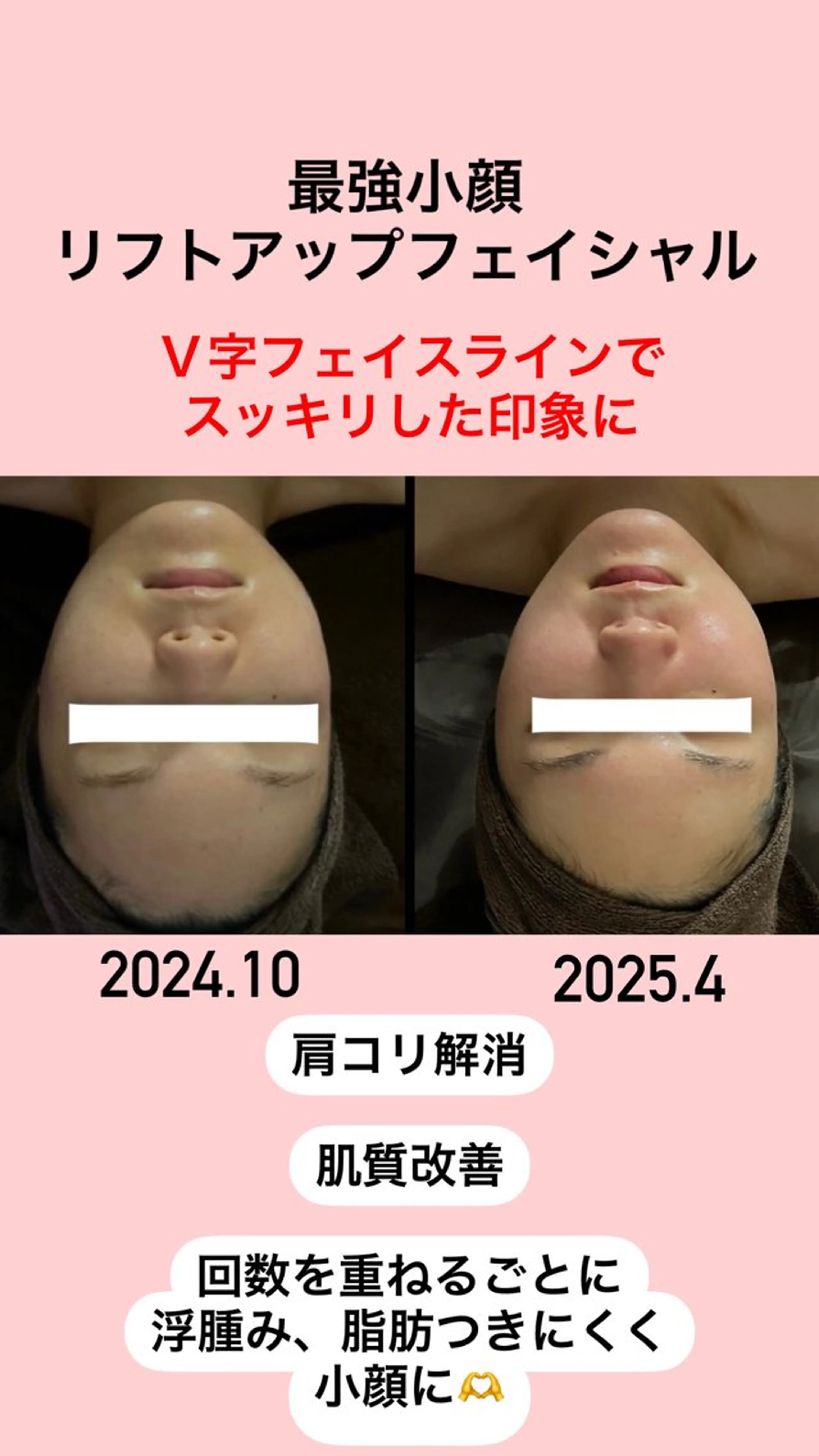 エステ リラク 美骨＆小顔矯正サロン　Clarte所属・骨から若返る美骨＆ 小顔サロンクラルテのエステ・リラクイメージ