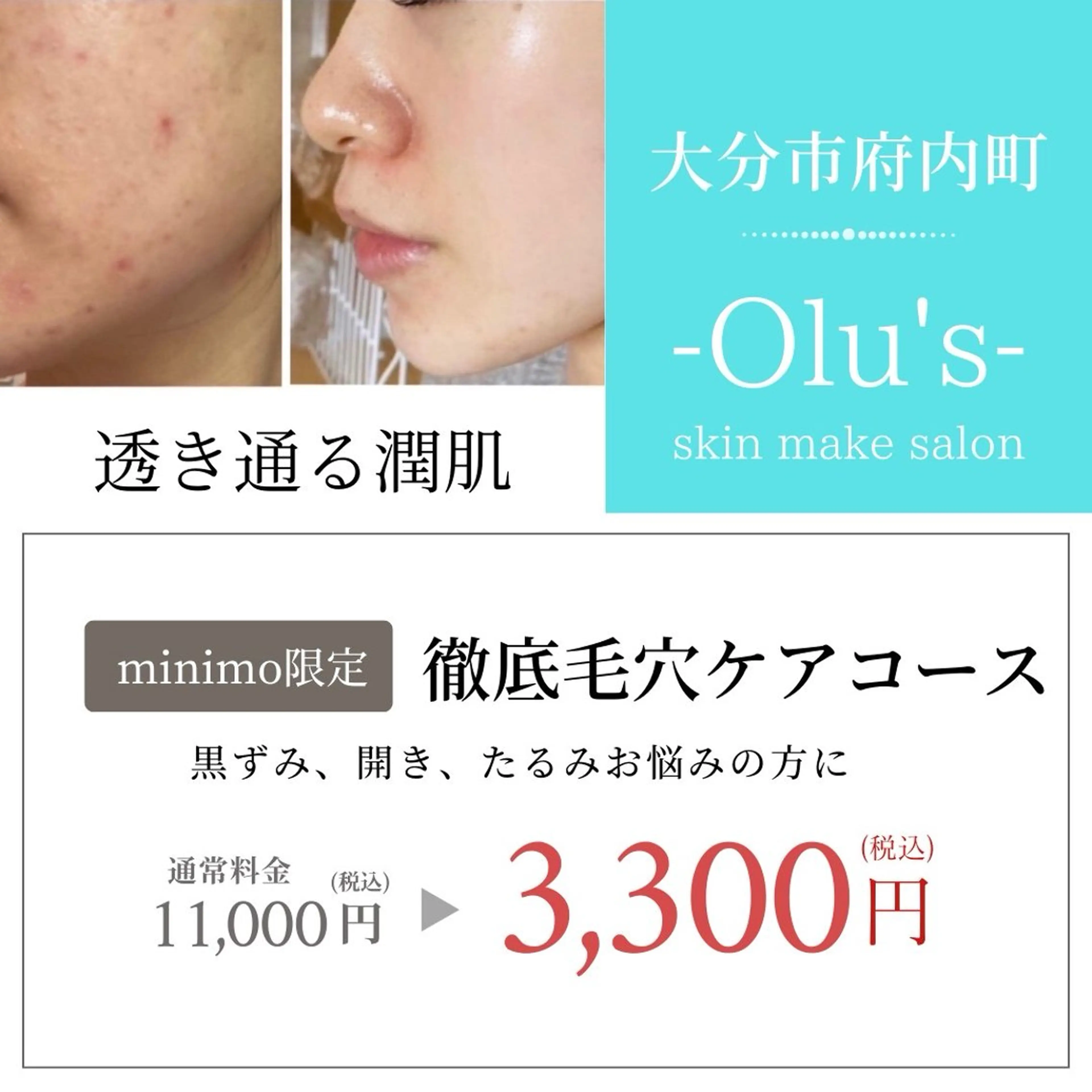 skin make salon -Olu's-所属・毛穴・肌質改善サロン ✨Tomaのその他イメージ