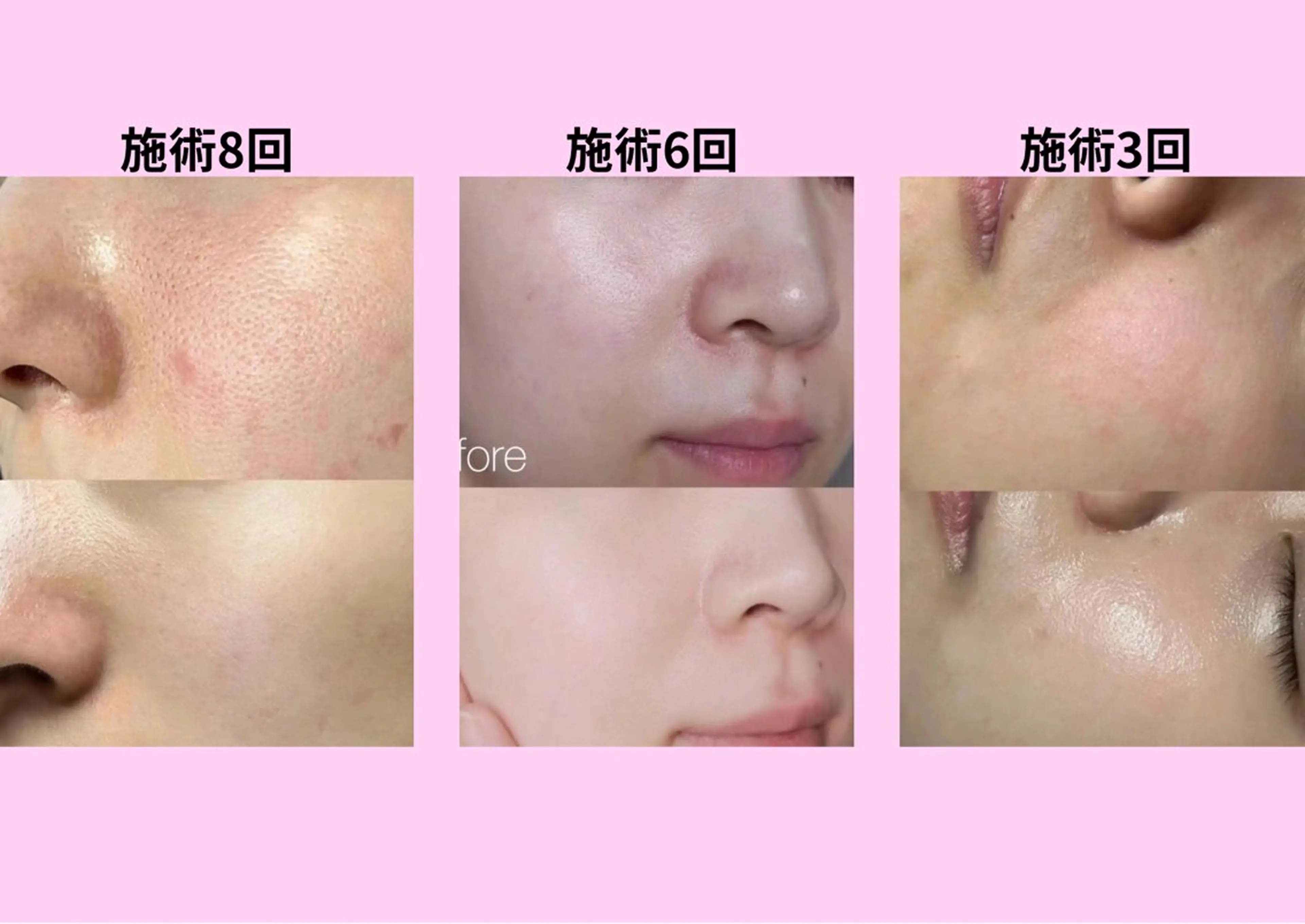 マツエク・マツパ エステ リラク 愛維美水光美肌専門店所属・愛維美水光美肌専門店 メンズレディースokのエステ・リラクイメージ