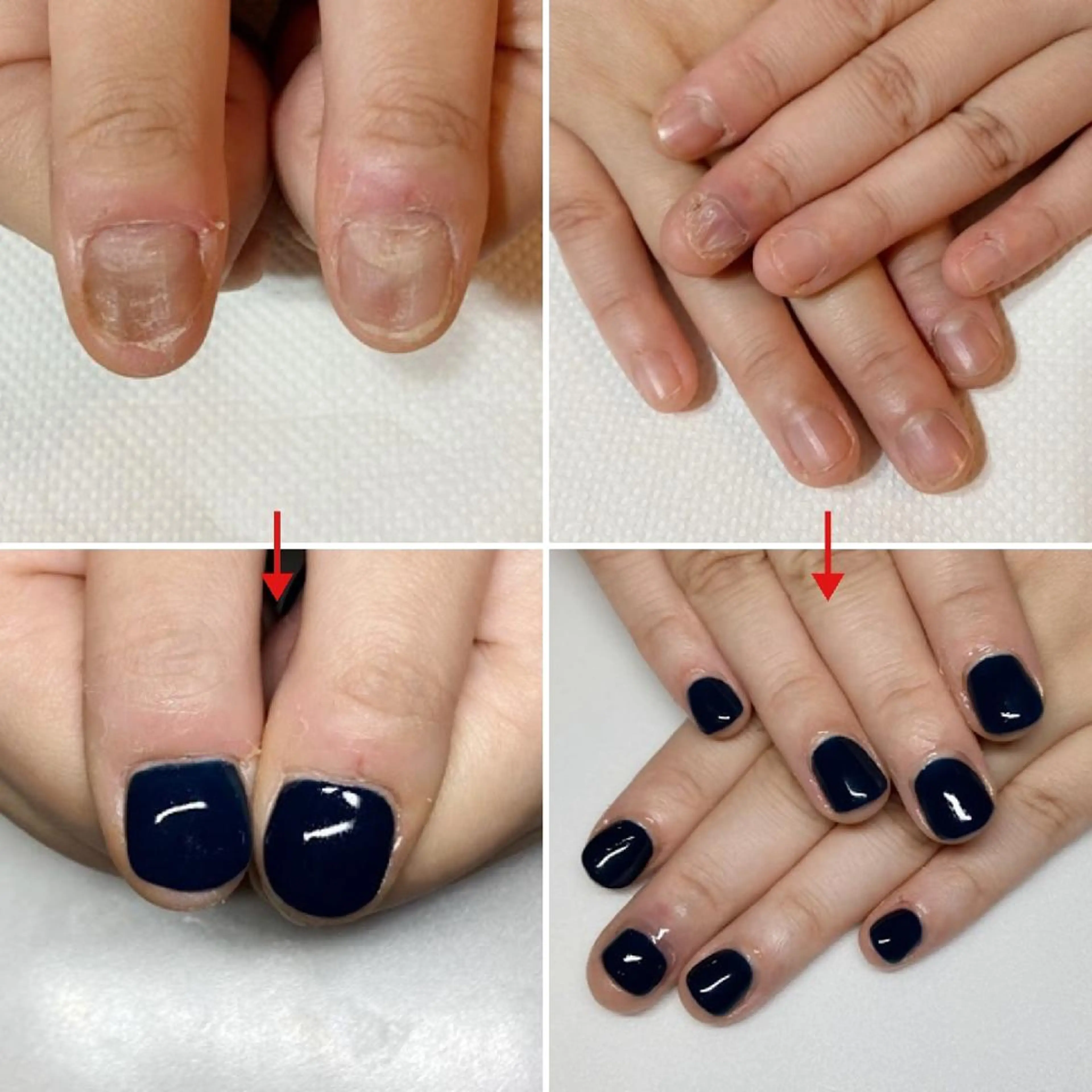 ネイル ネイルサロンアリューム所属・ネイルサロン アリュームのネイルデザイン