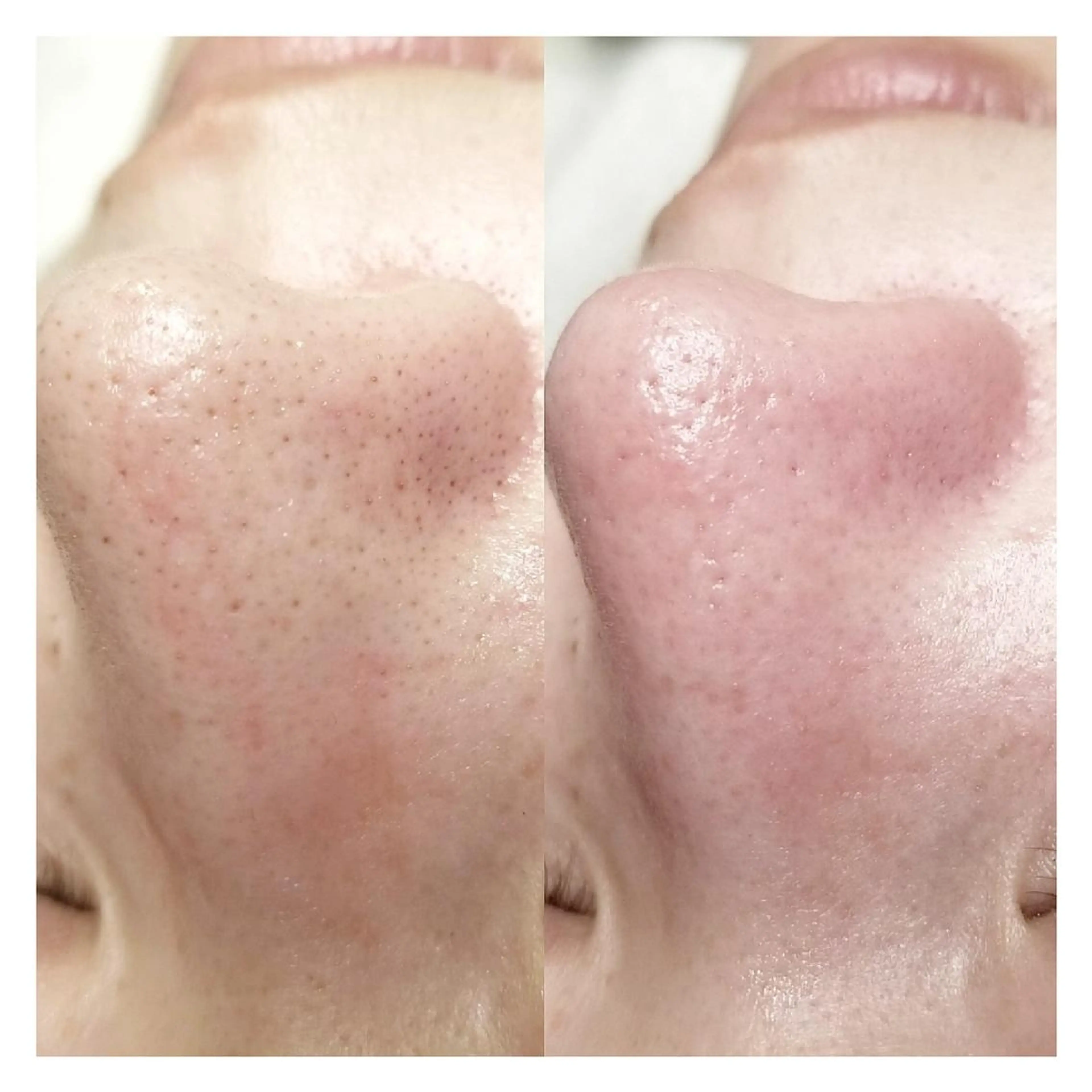 U_la所属・U_la [ウーラ] 片岡の眉毛・アイブロウイメージ