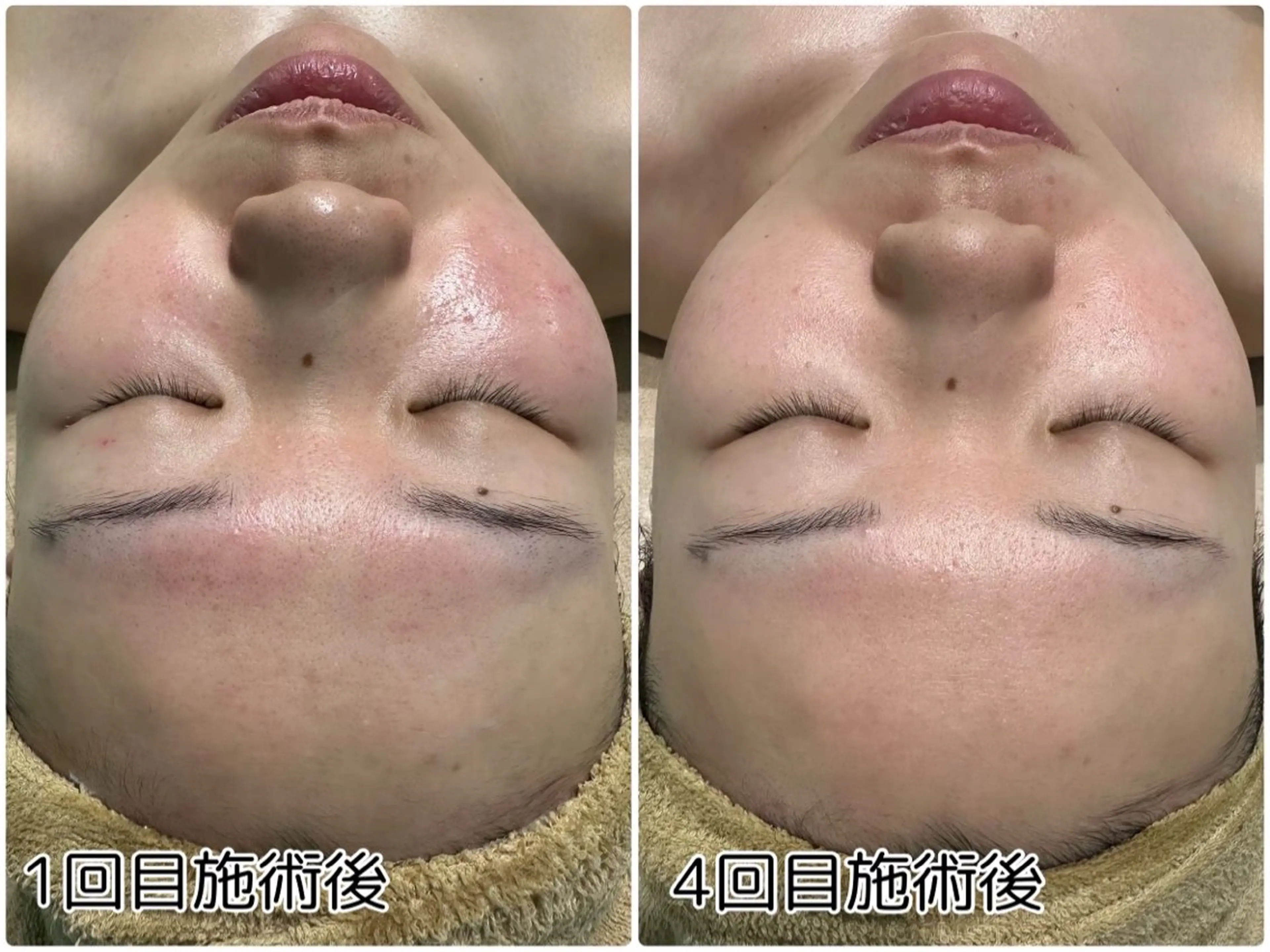 エステ リラク One .Erikaのエステ・リラクイメージ