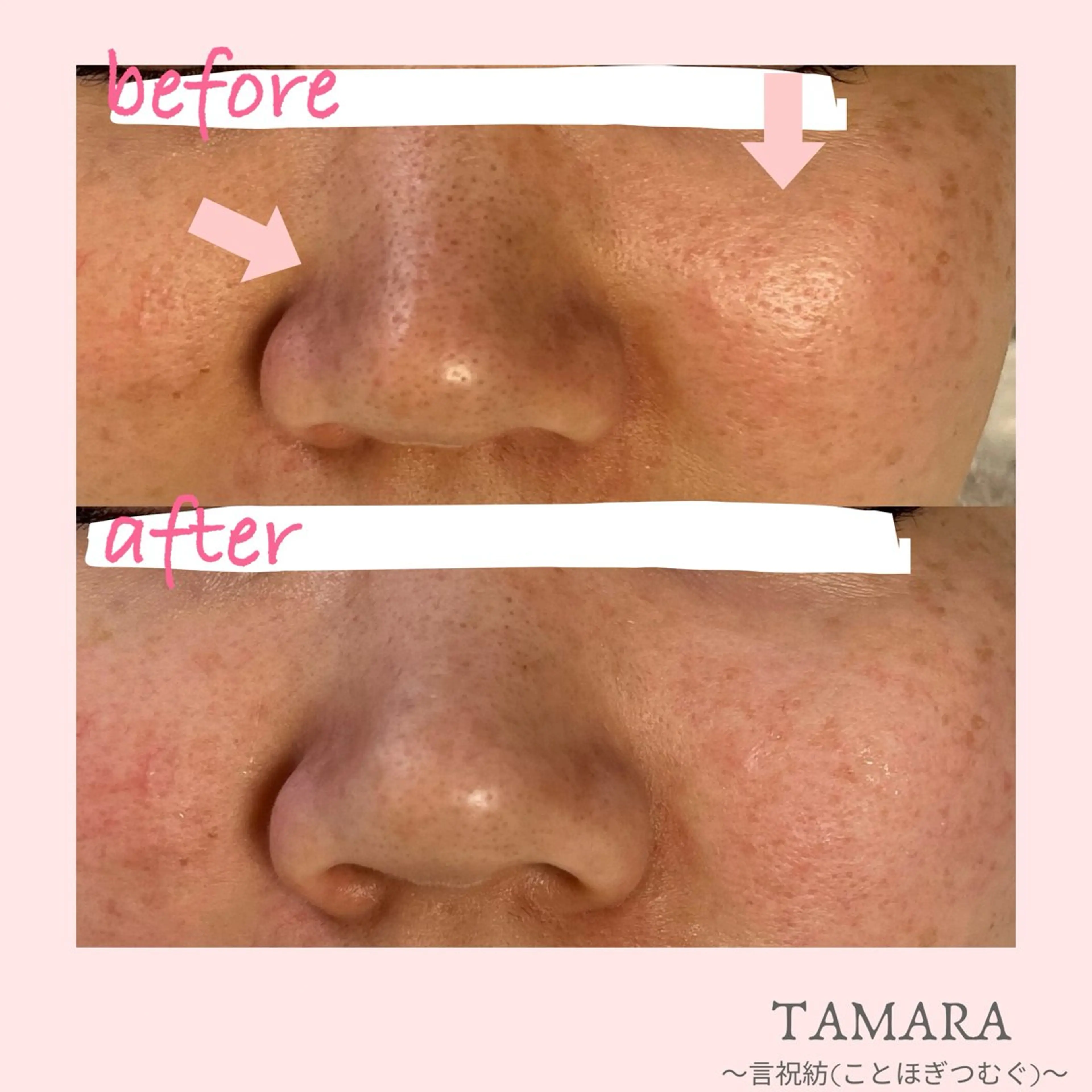 TAMARA 松下のエステ・リラクイメージ