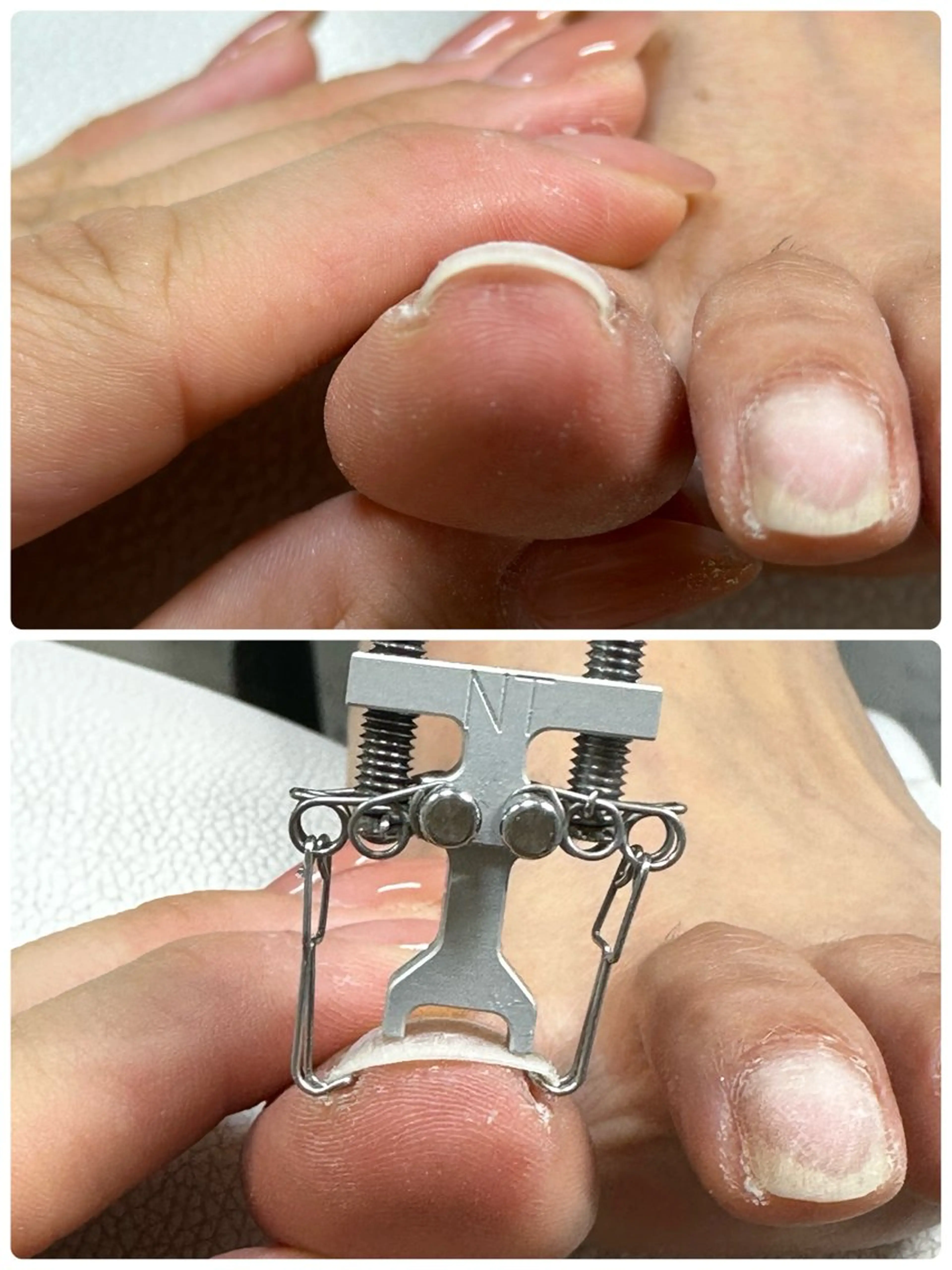 ネイル 福田 加奈のネイルデザイン