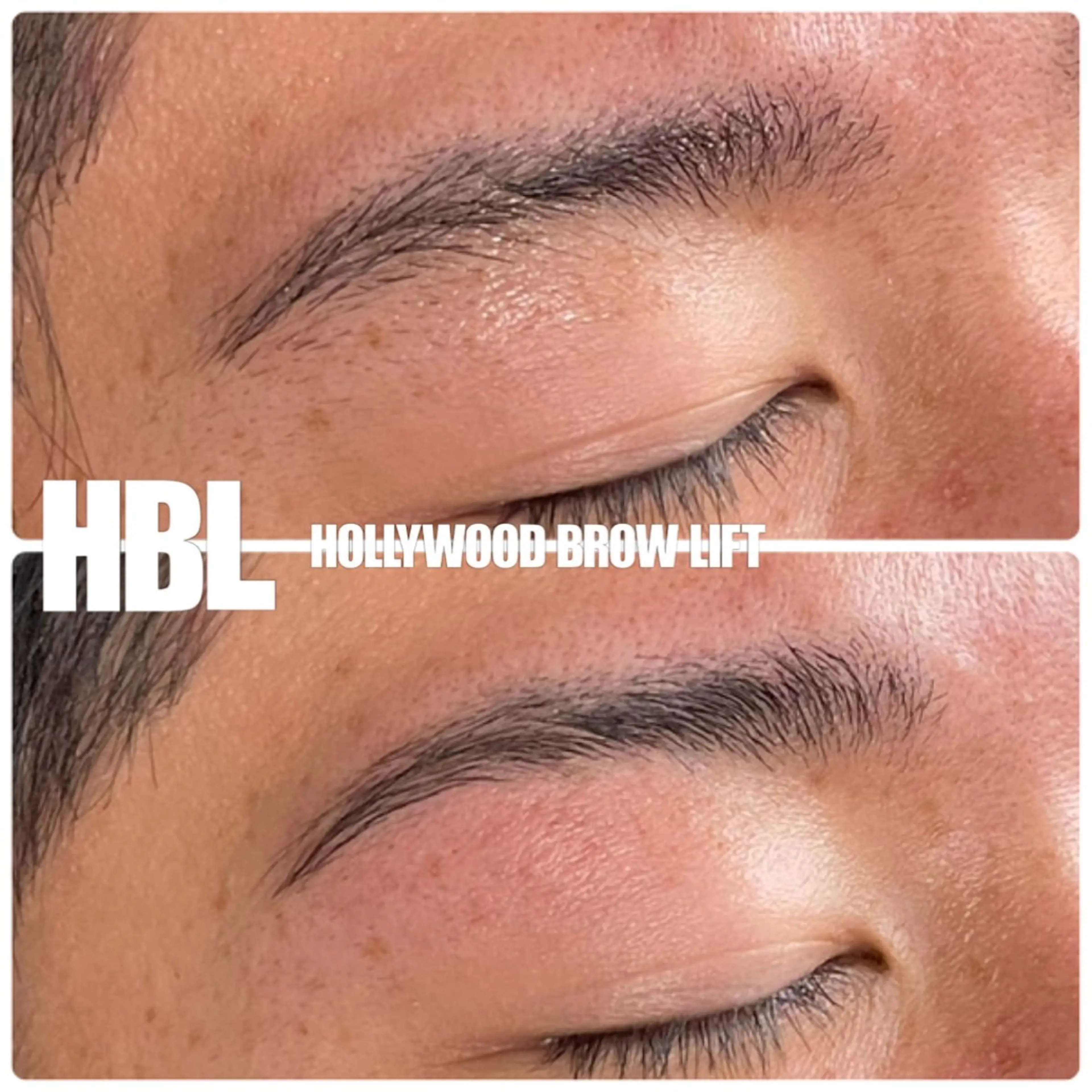 ハリウッドブロウリフト【HBL】の写真