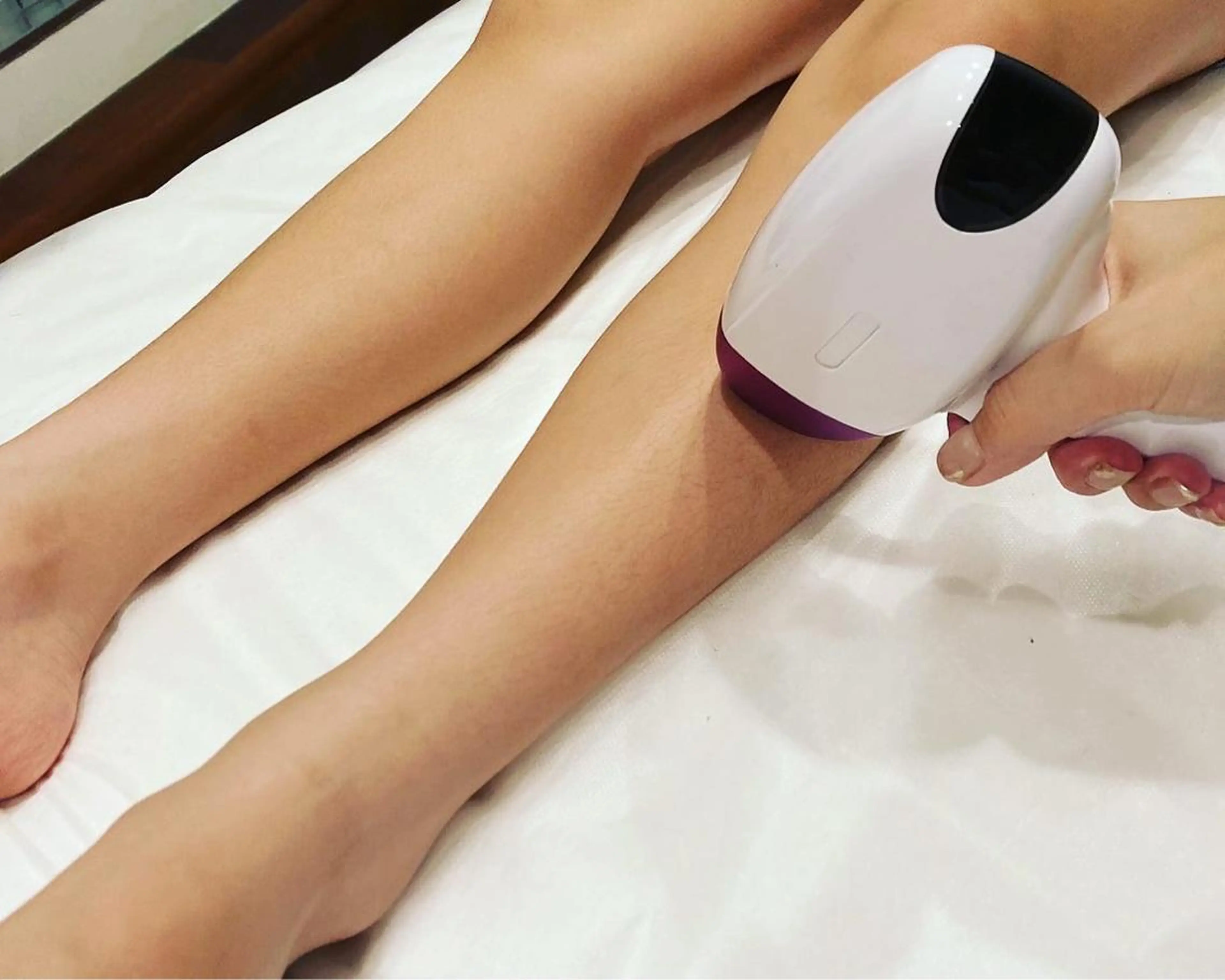 全身脱毛☆顔vio込み　最新LED脱毛機使用☆の写真