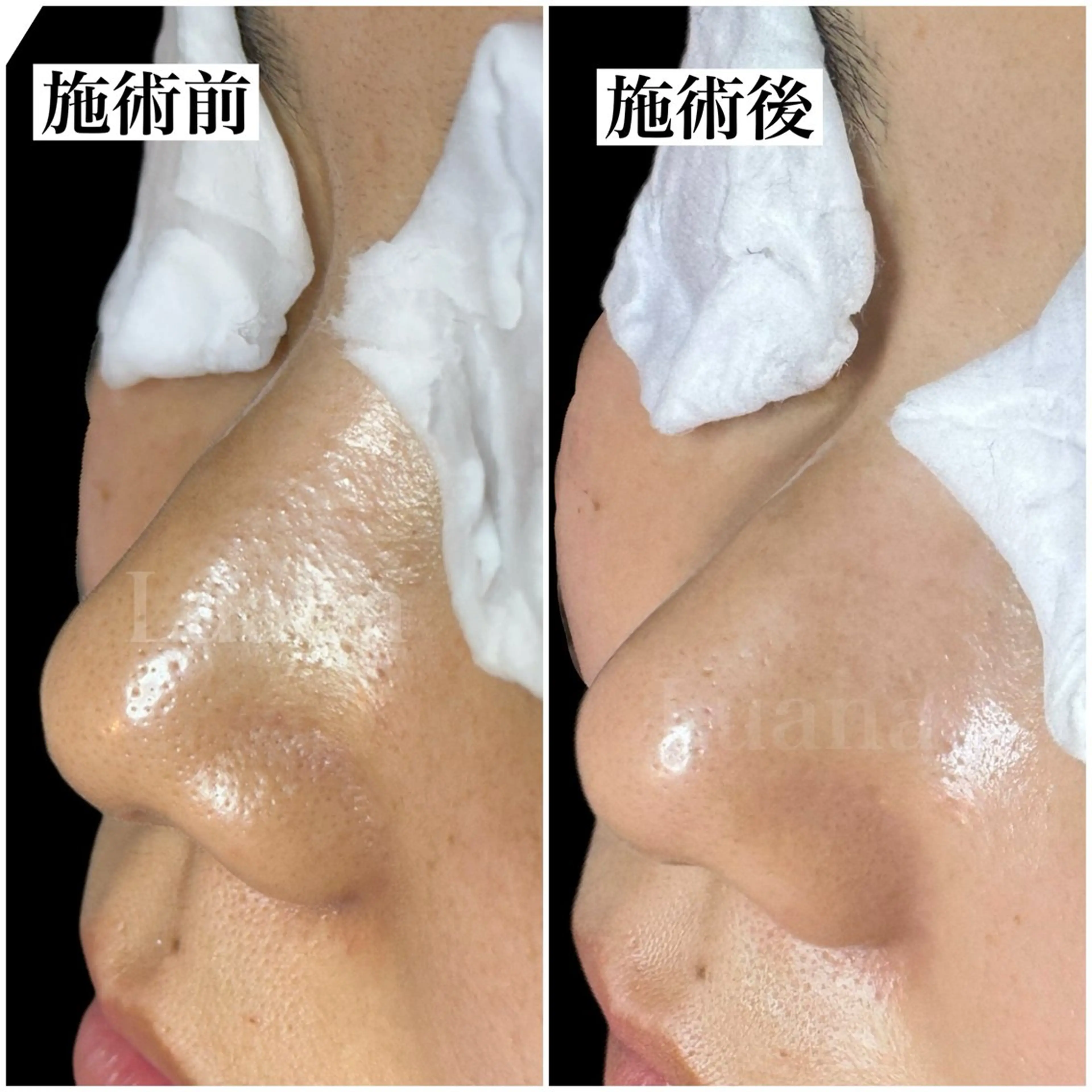 マツヤニWax専門/ 岸和田/Luanaのエステ・リラクイメージ