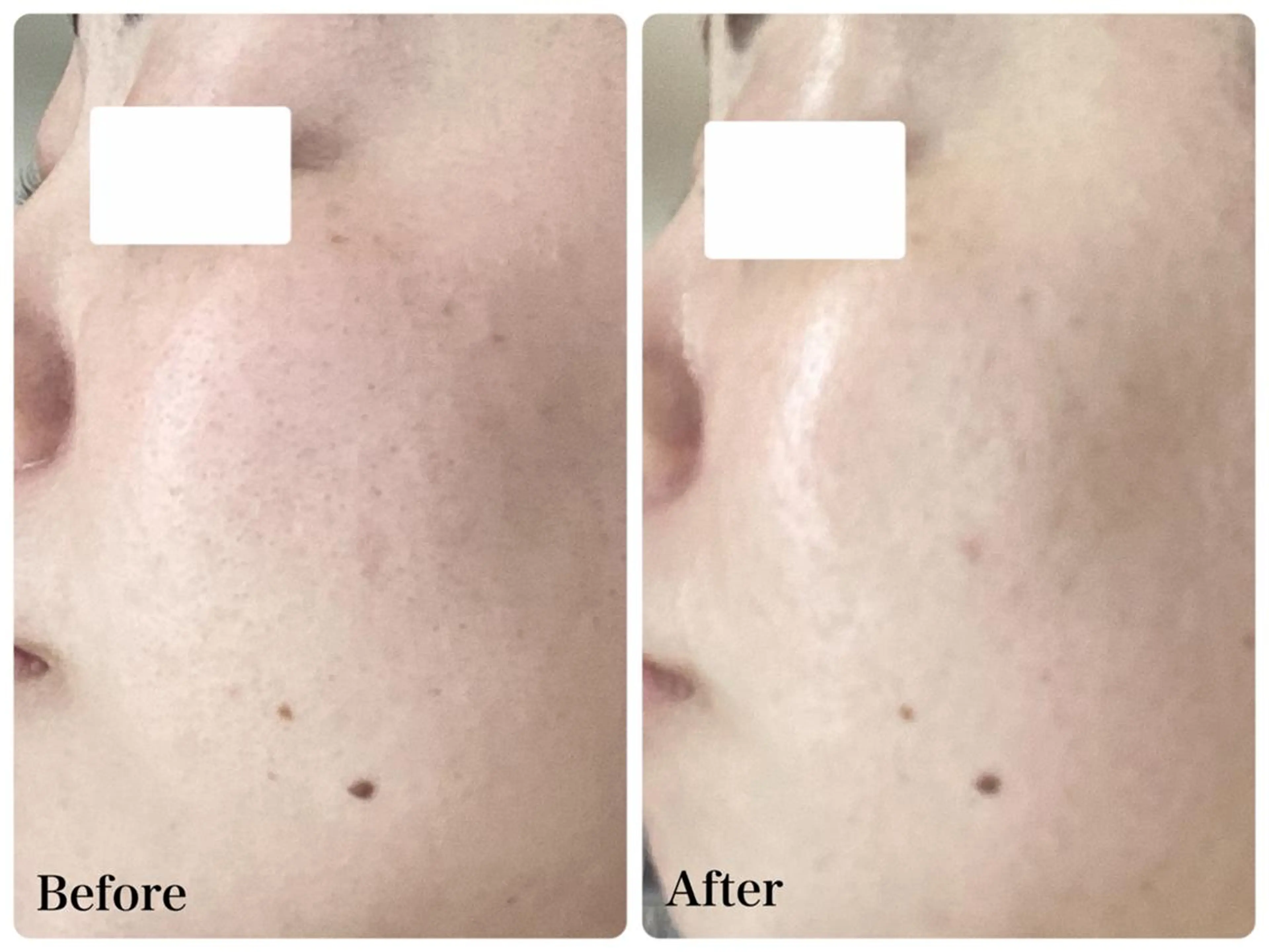 エステ リラク パーソナルエステ L'purのエステ・リラクイメージ