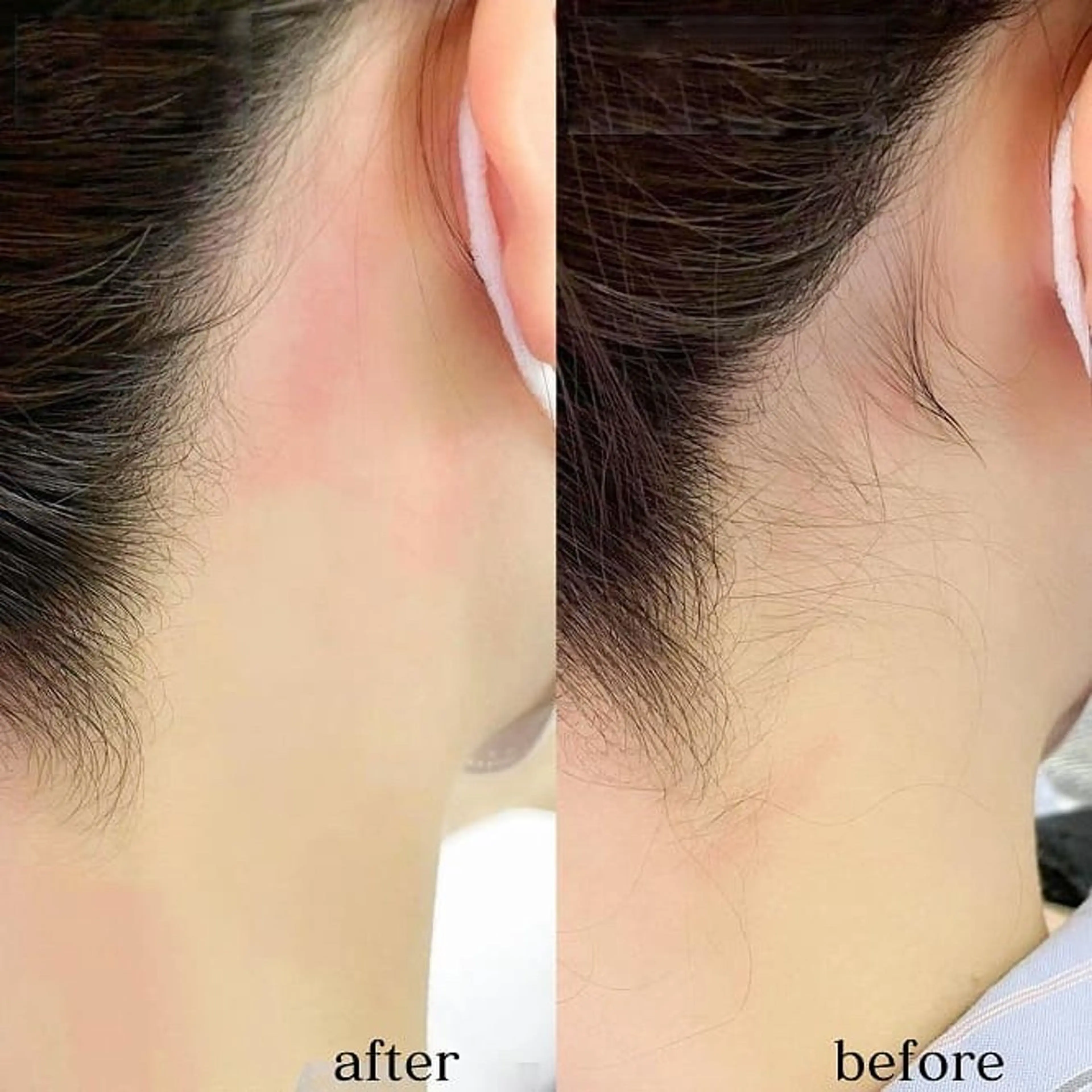 【SNSモニター】お好きな部位のパーツワックスの写真