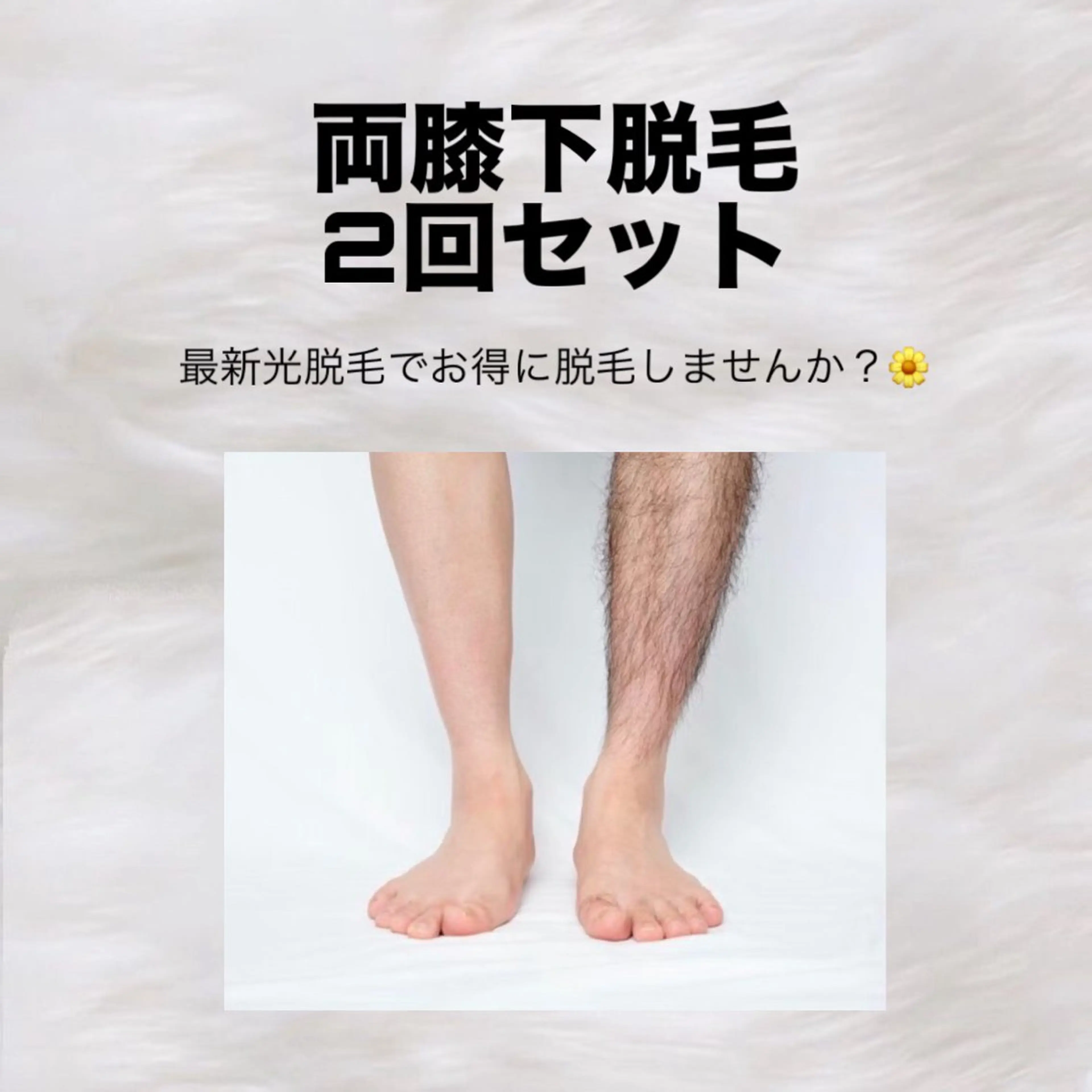 🌈最新光脱毛🌈両ひざ下脱毛2回セット特別価格の写真