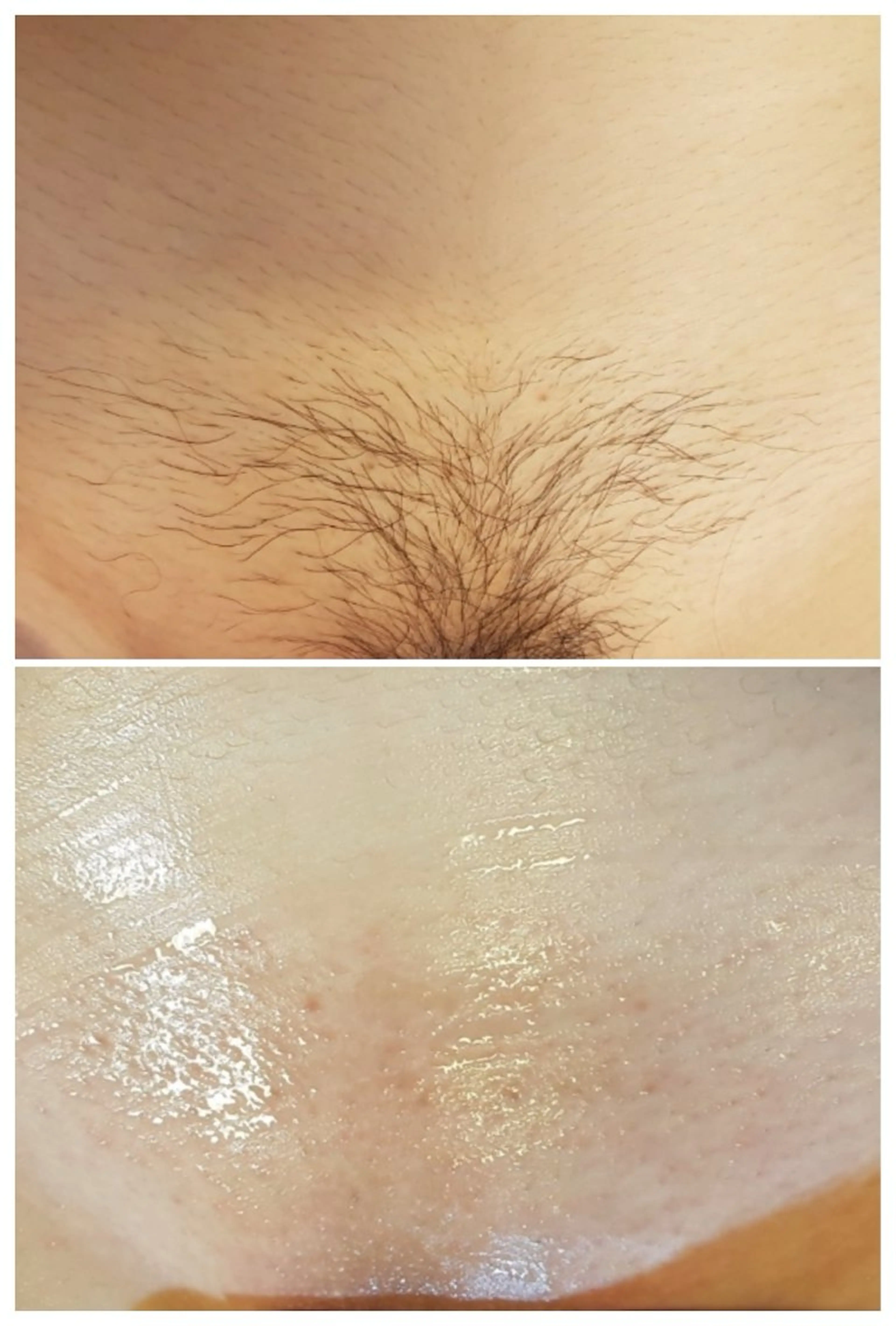 脱毛 TAKAMATSU RINAのネイルデザイン