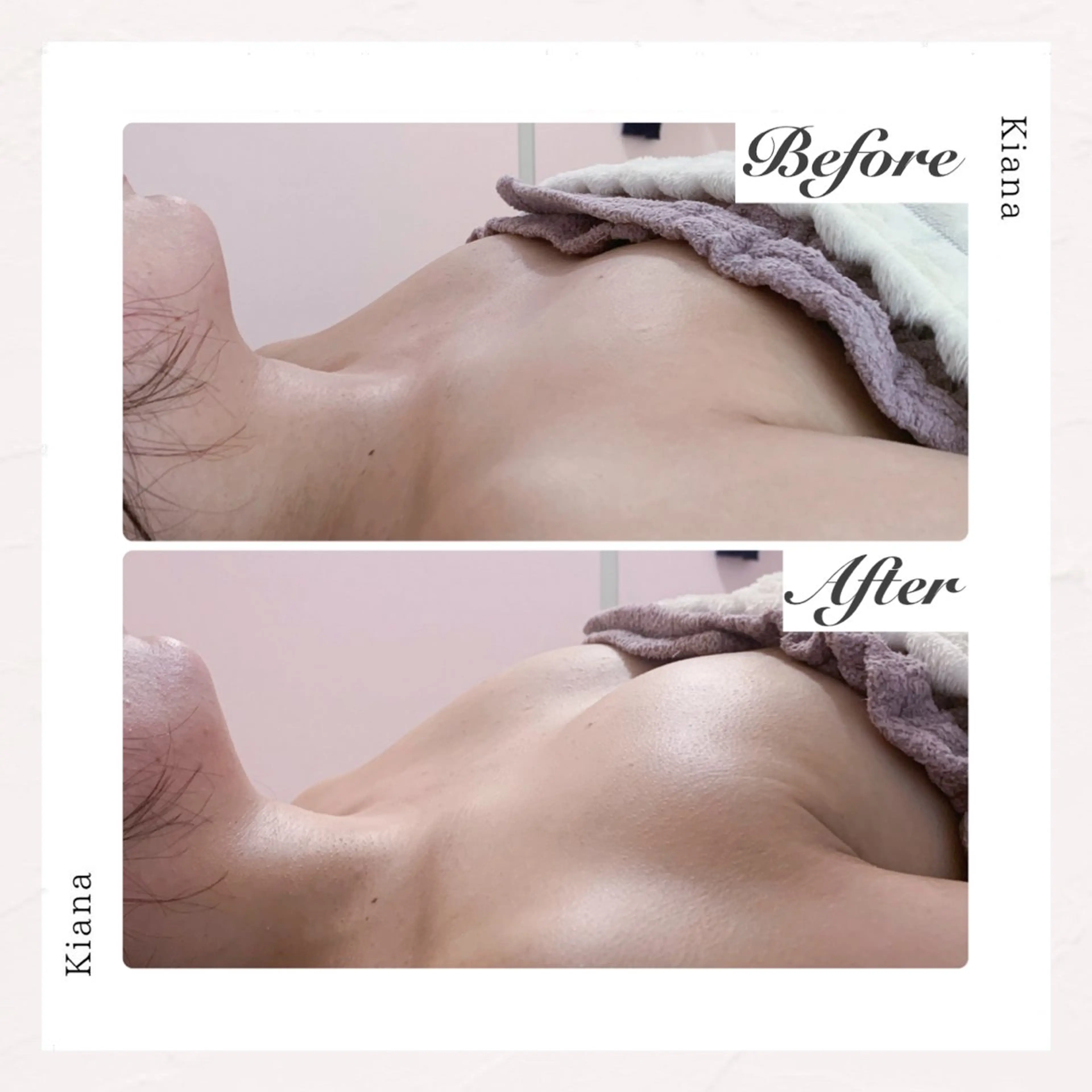 バスト専門Kiana 風のエステ・リラクイメージ