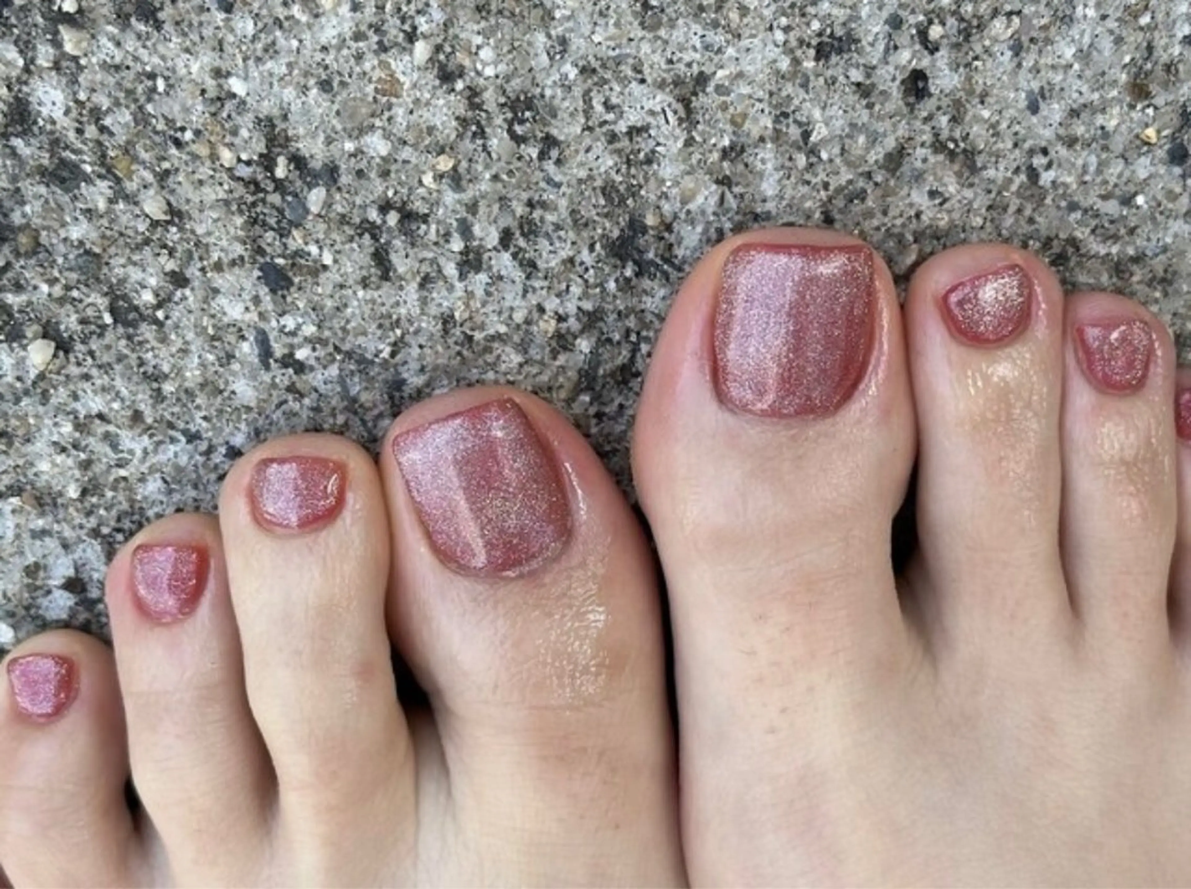 フット　マグネットネイルの写真