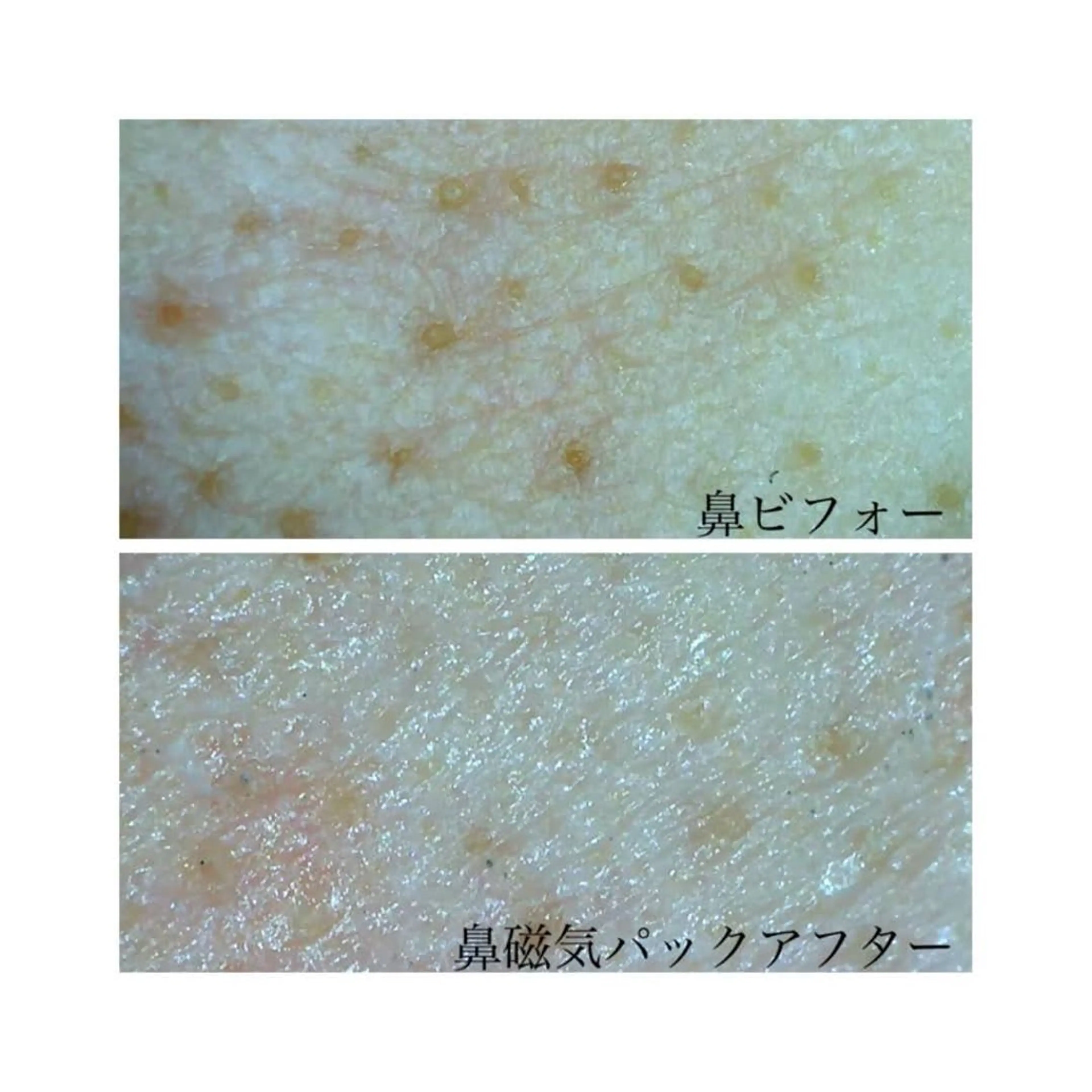 1番人気フェイシャルメニュー!ドライヘッドスパ付き【即効美白パック 50分】の写真