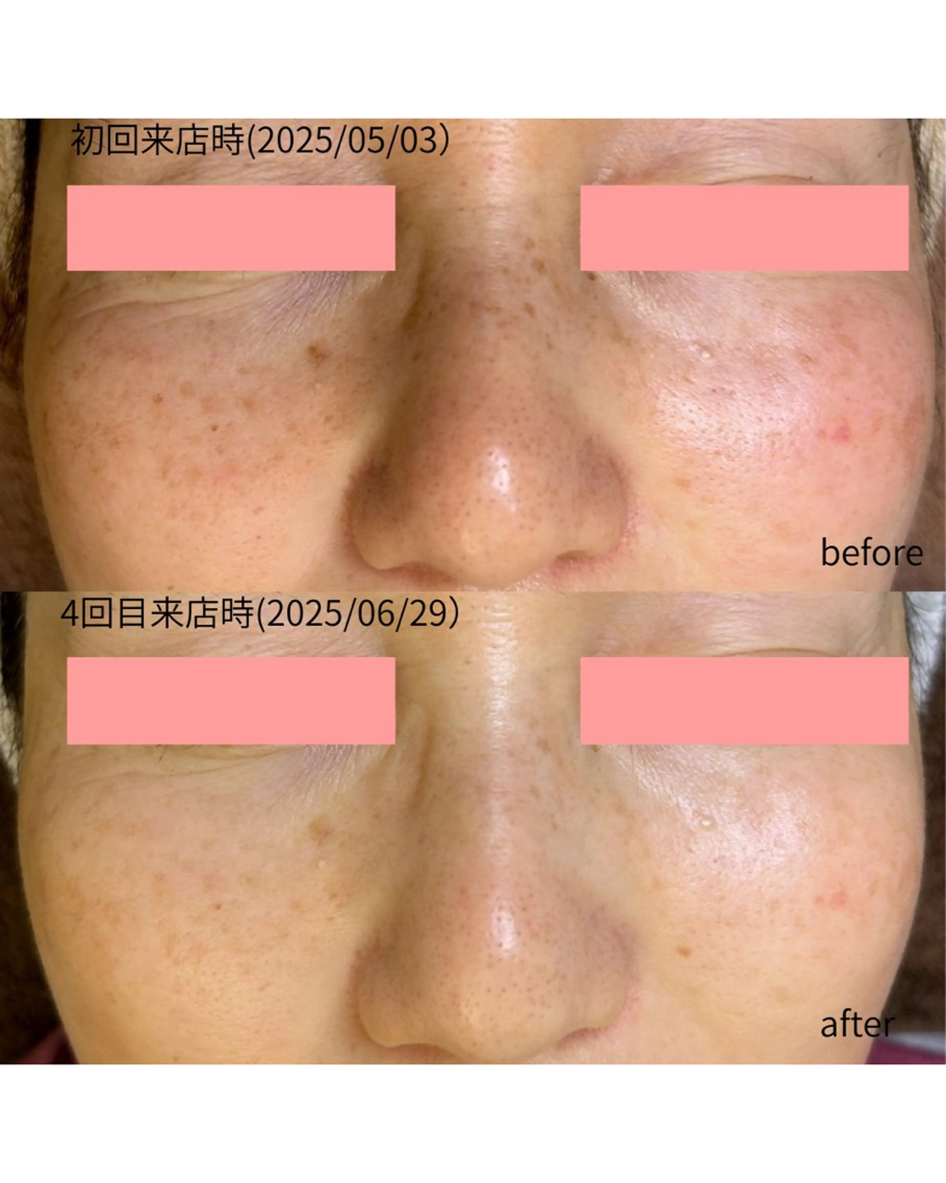 伊藤 稚菜のエステ・リラクイメージ