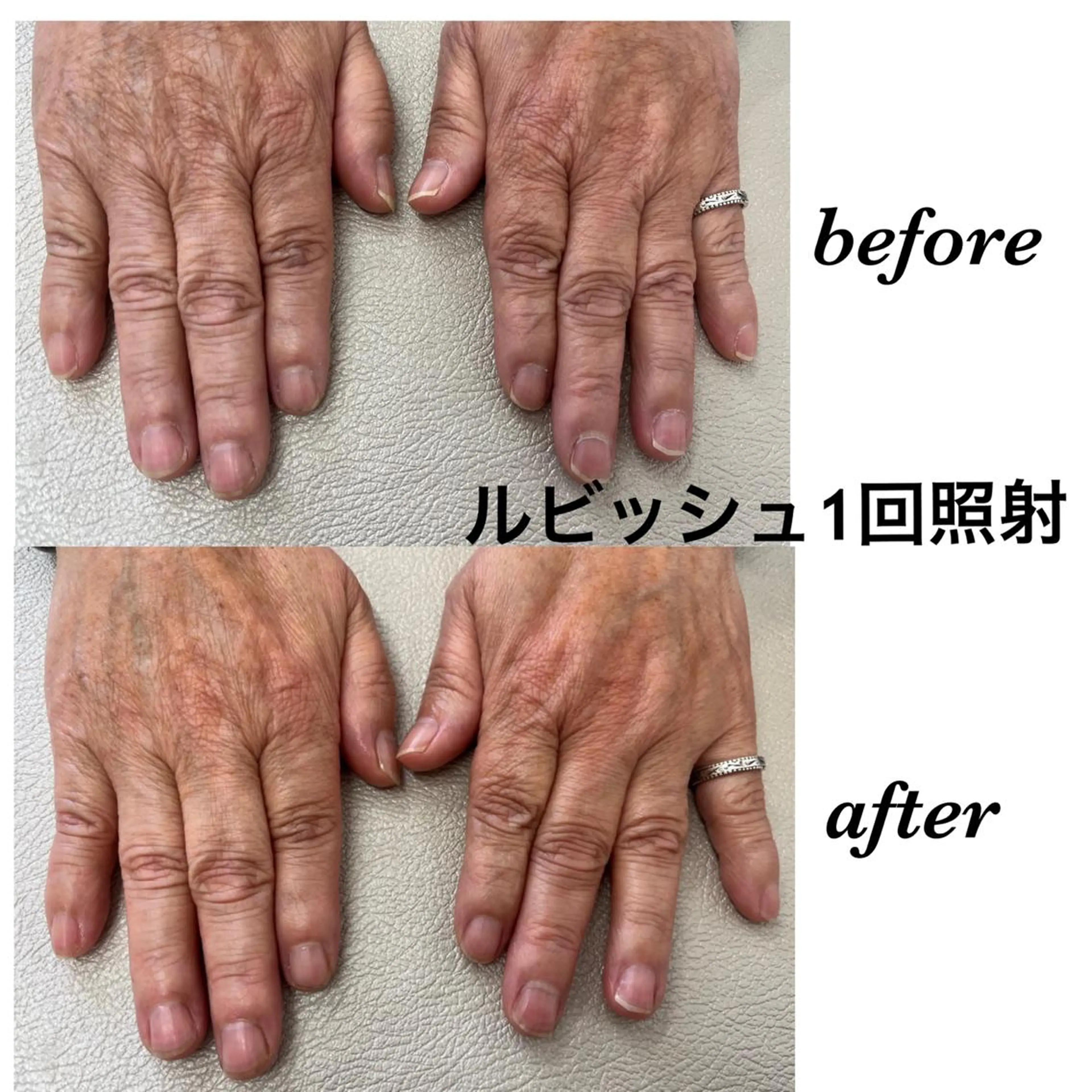 ネイル Regene ARAKIのネイルデザイン