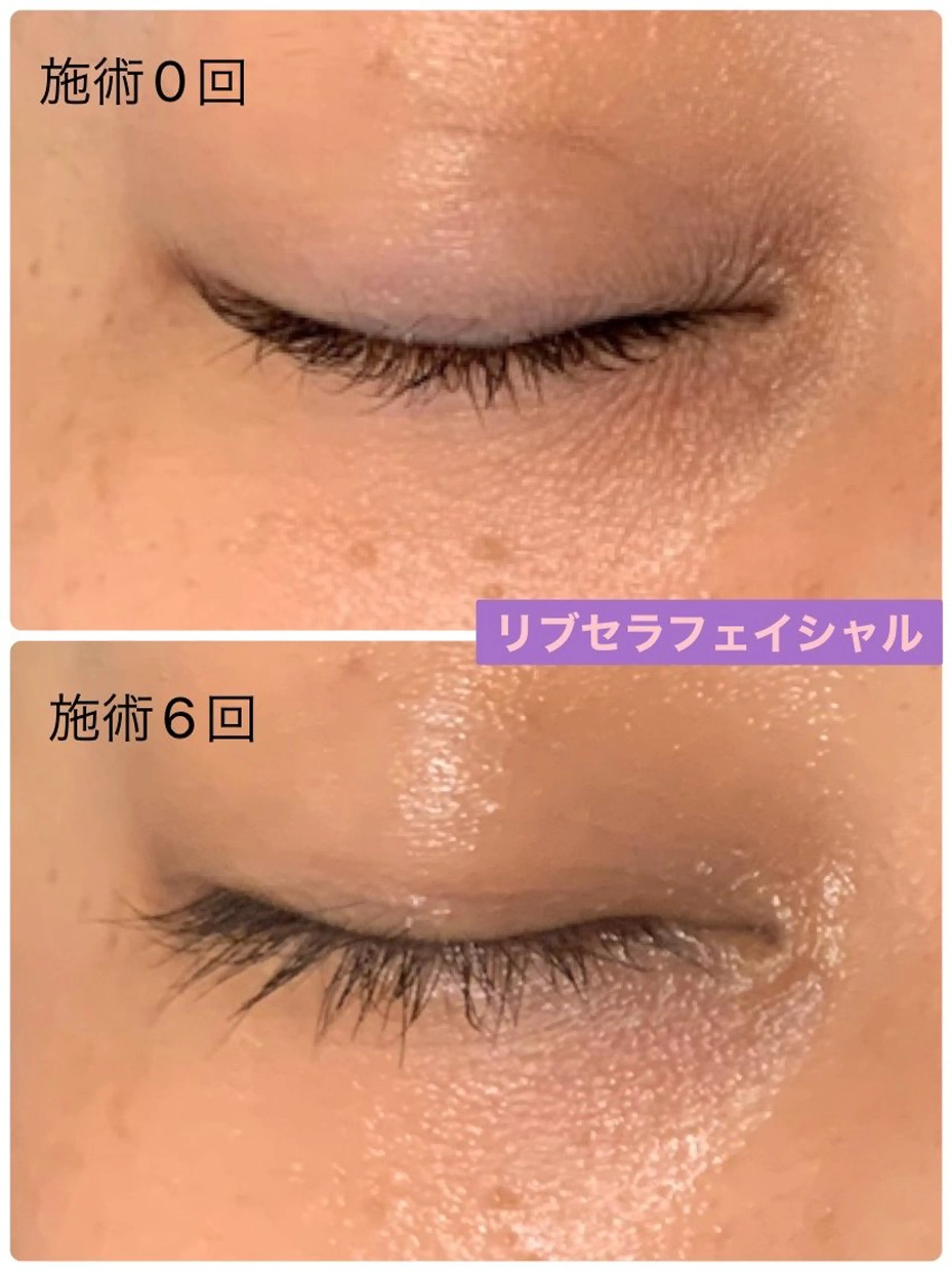 エステ Private Salon Prunelle所属・プライベートサロン プリュネルのエステ・リラクイメージ