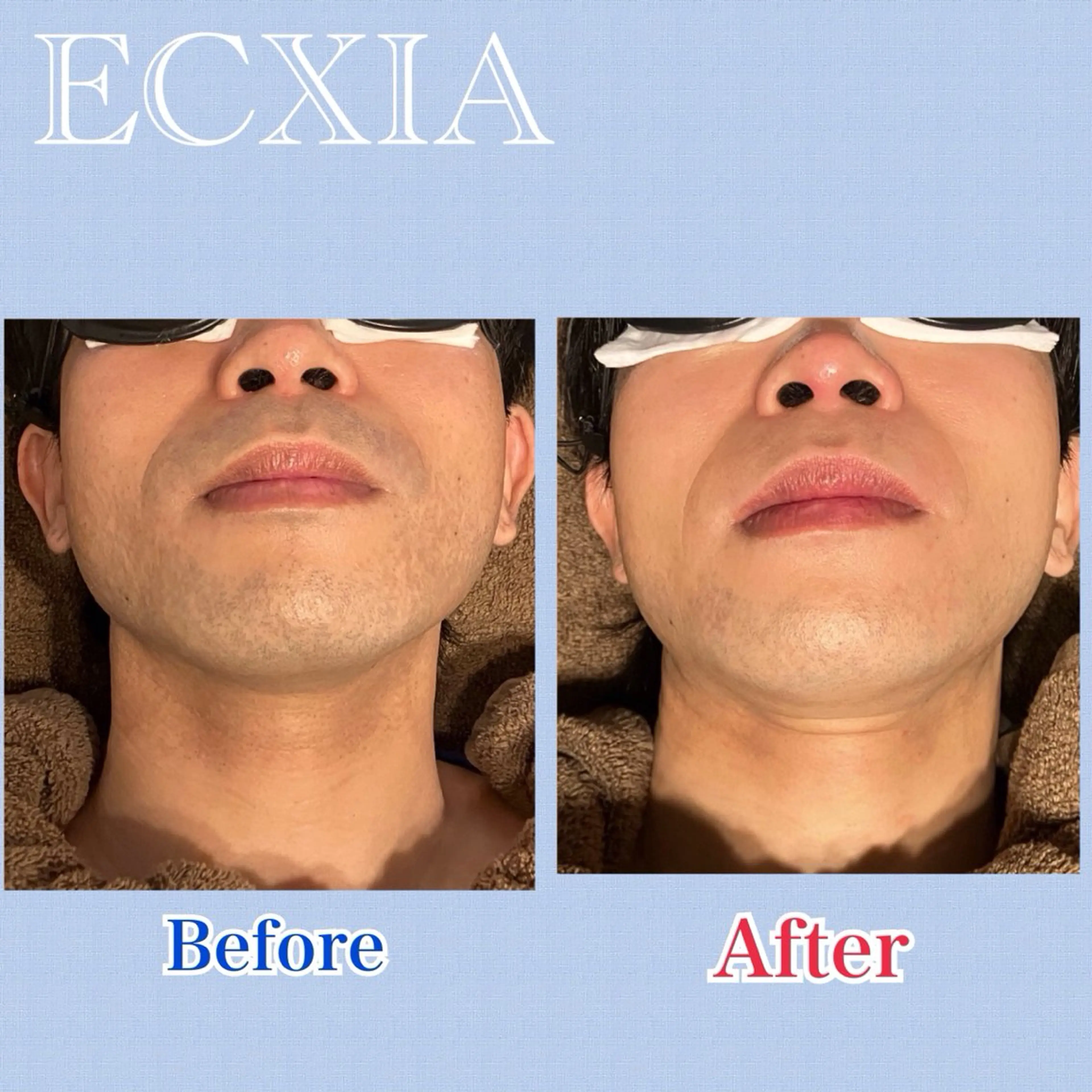 脱毛 脱毛サロン ECXIA【博多】のエステ・リラクイメージ