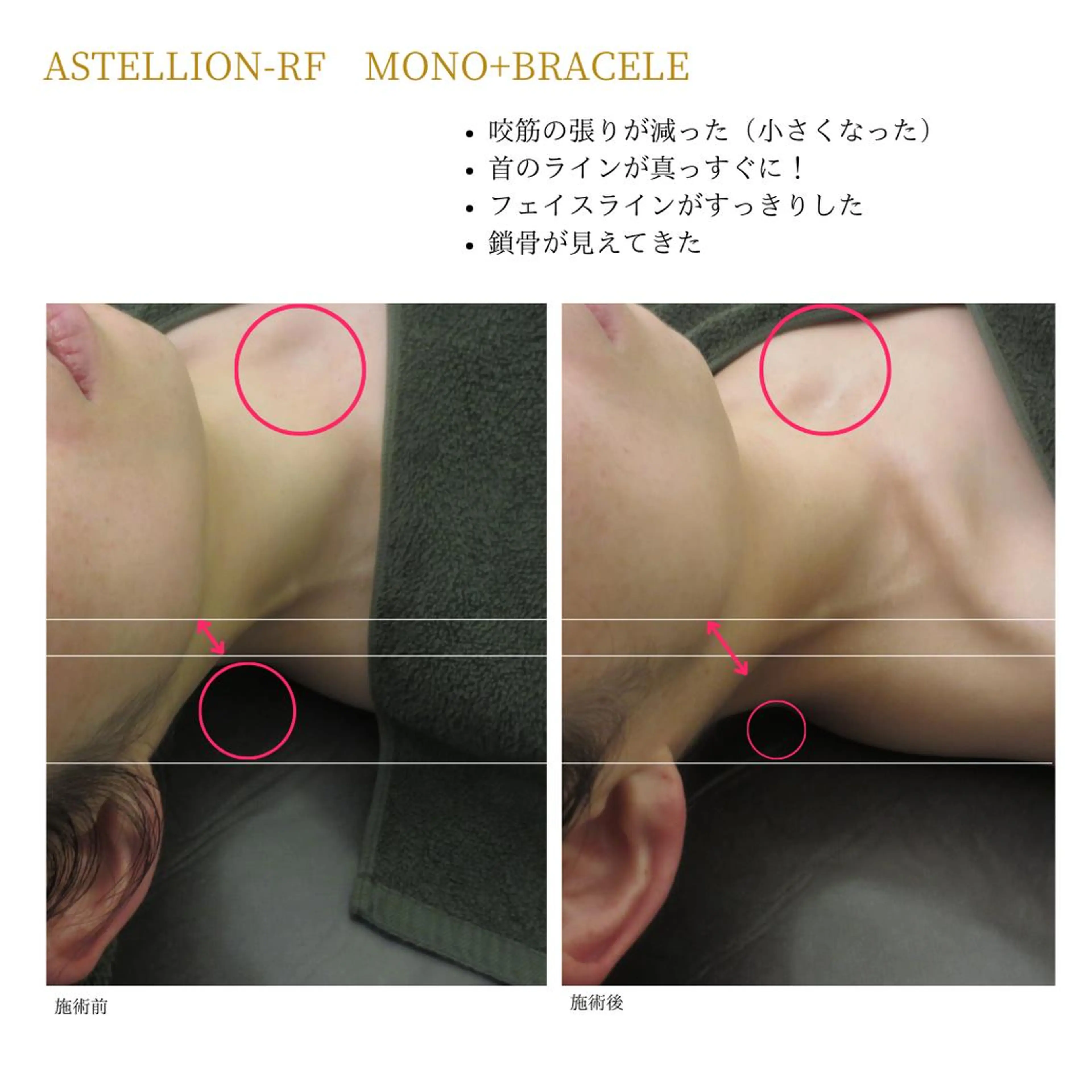 Sylphya (シルフィア)のエステ・リラクイメージ