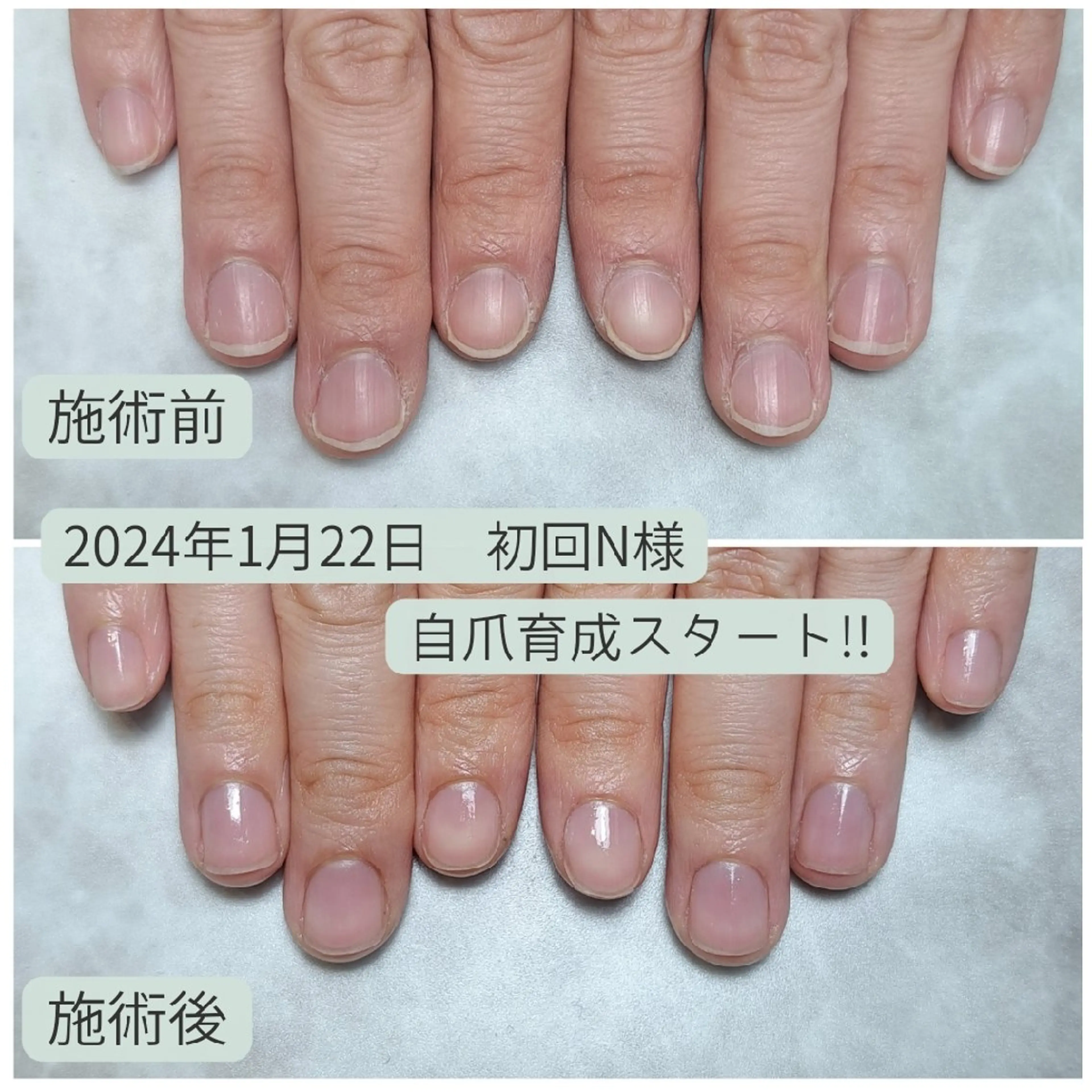 ネイル ジェルネイル スカルプネイル ハンドケア AKT NAIL所属・AKT Beauty エステヘッドスパのエステ・リラクイメージ