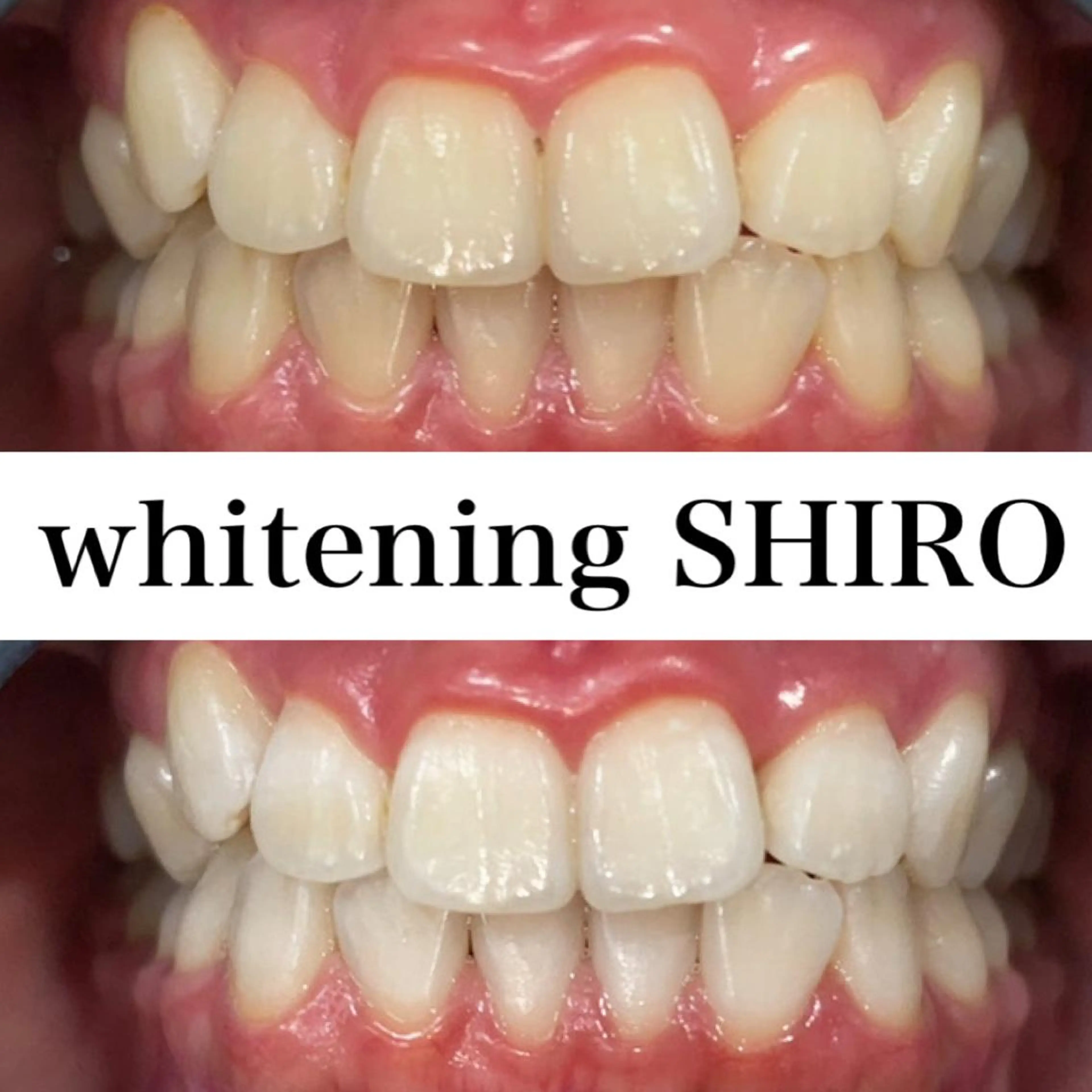 福岡ホワイトニング SHIRO天神店のエステ・リラクイメージ