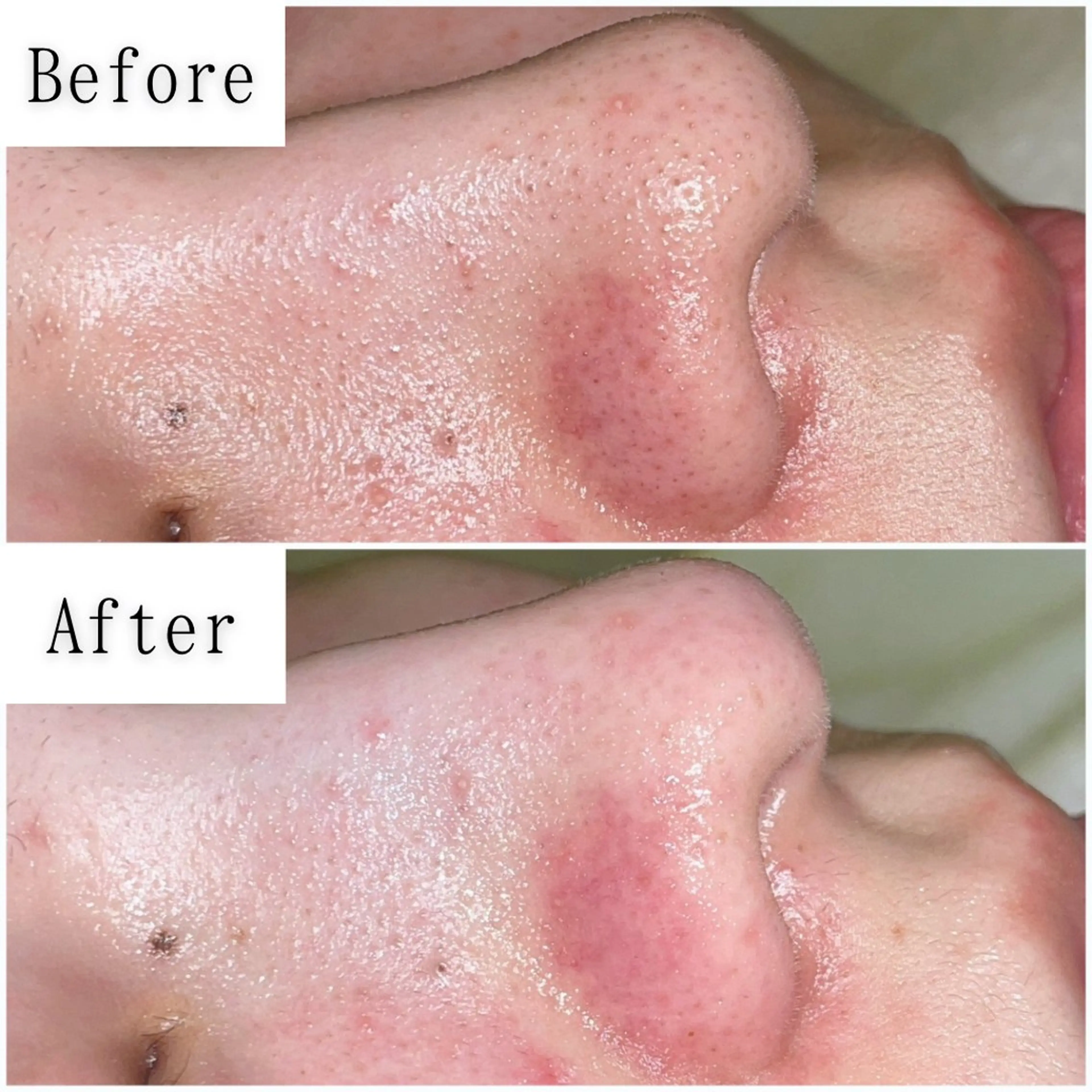 その他 SELF  BEAUTY gracia浦添店所属・gracia 浦添店のその他イメージ