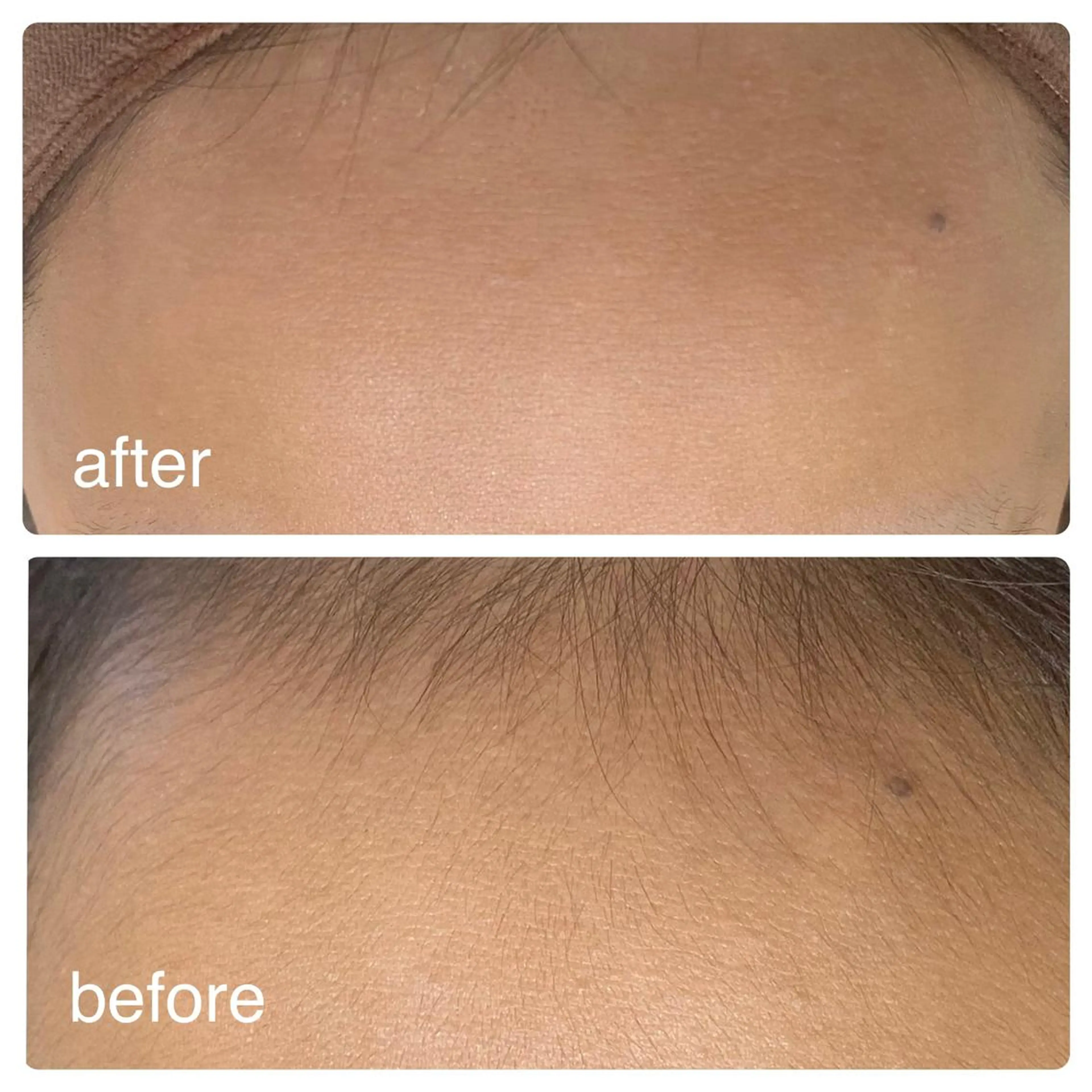 YOLO 梅郷店所属・YOLO痩身/脱毛 🌼MARI🌼のエステ・リラクイメージ