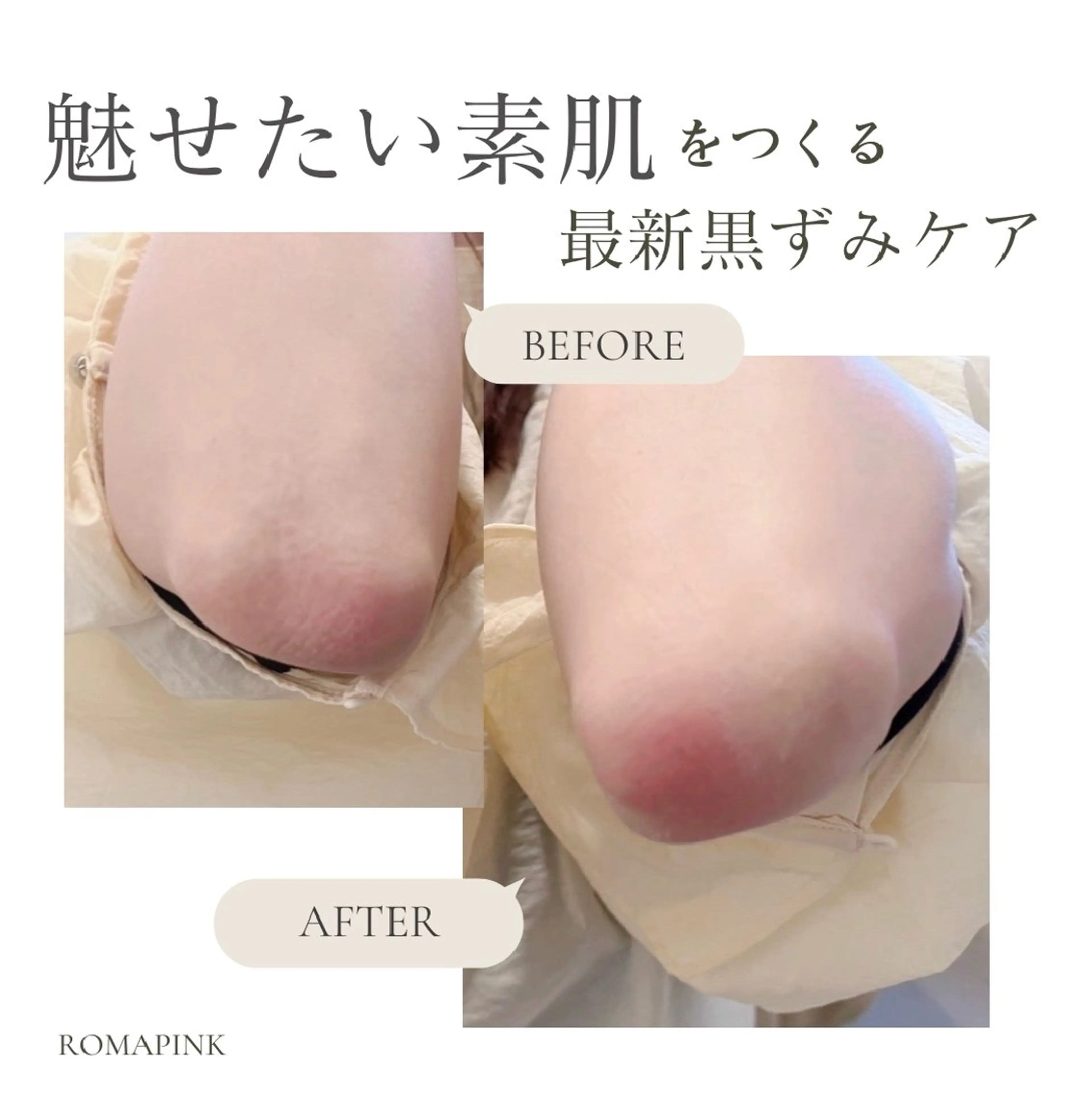 ELEGANCE所属・メンズ脱毛サロン BRIGHTのエステ・リラクイメージ