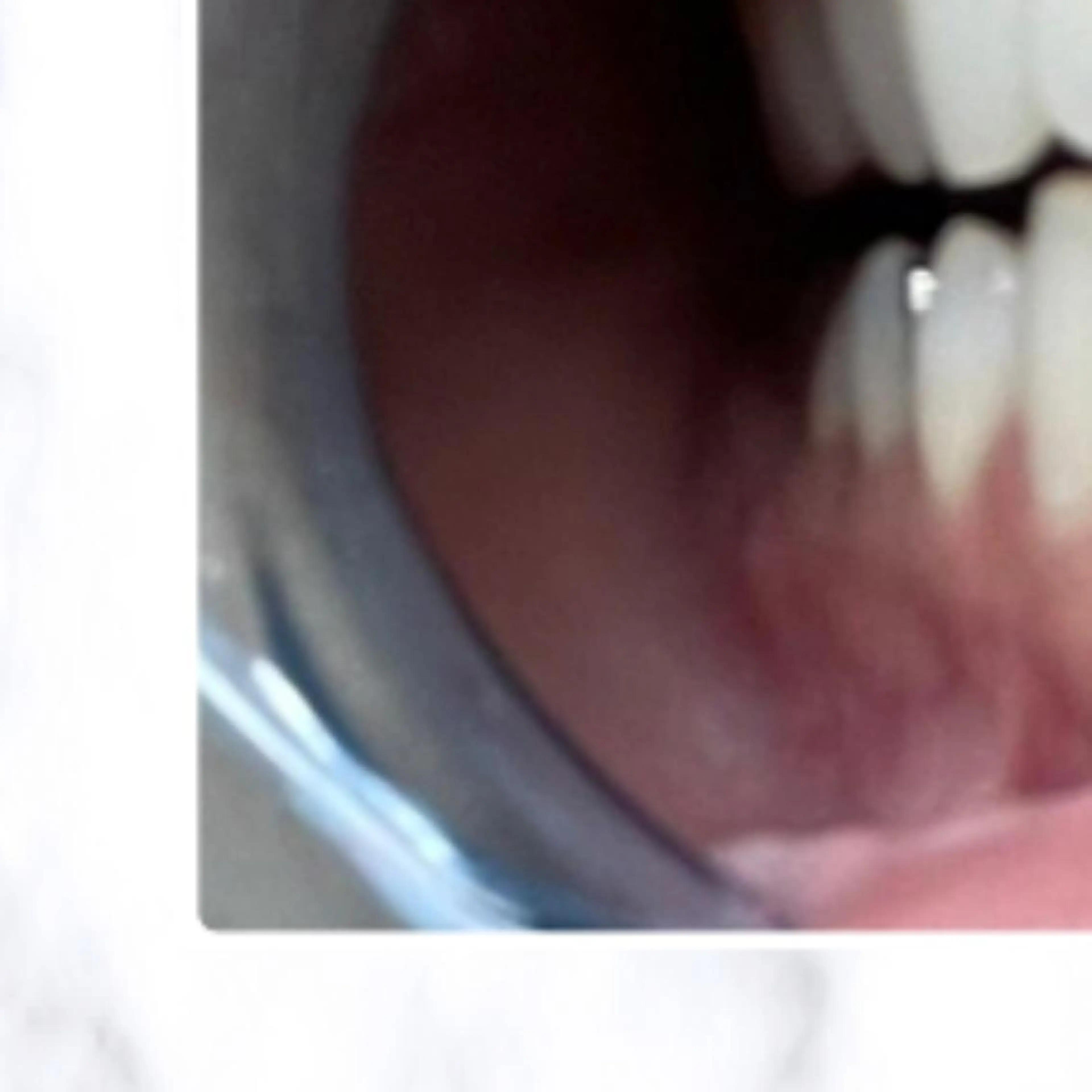 その他 ライトケアサロン 渋谷店② 渡邊のその他イメージ