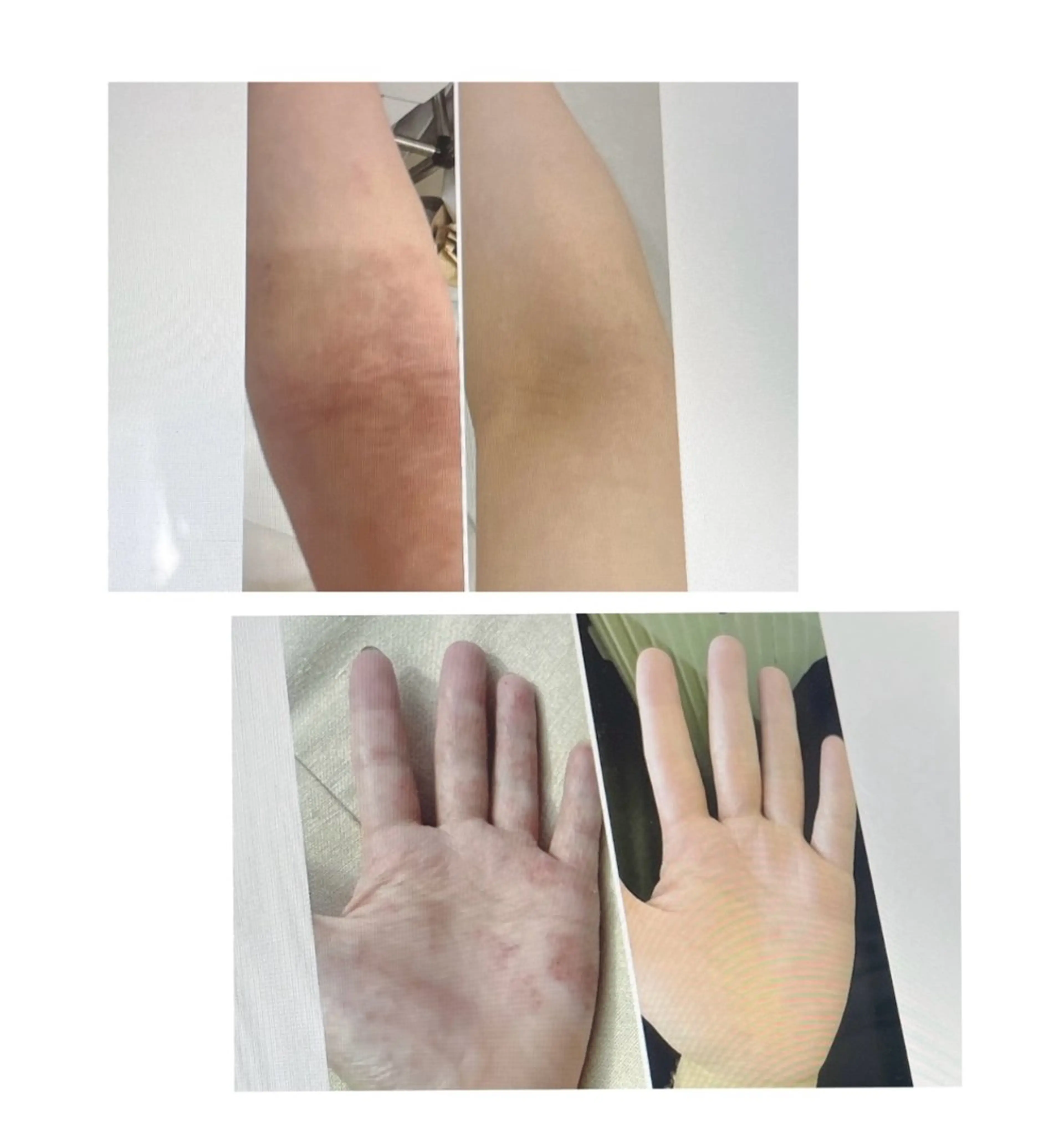 luana-ルアナ-所属・最高に輝く花嫁姿へ ブライダルsaronのエステ・リラクイメージ