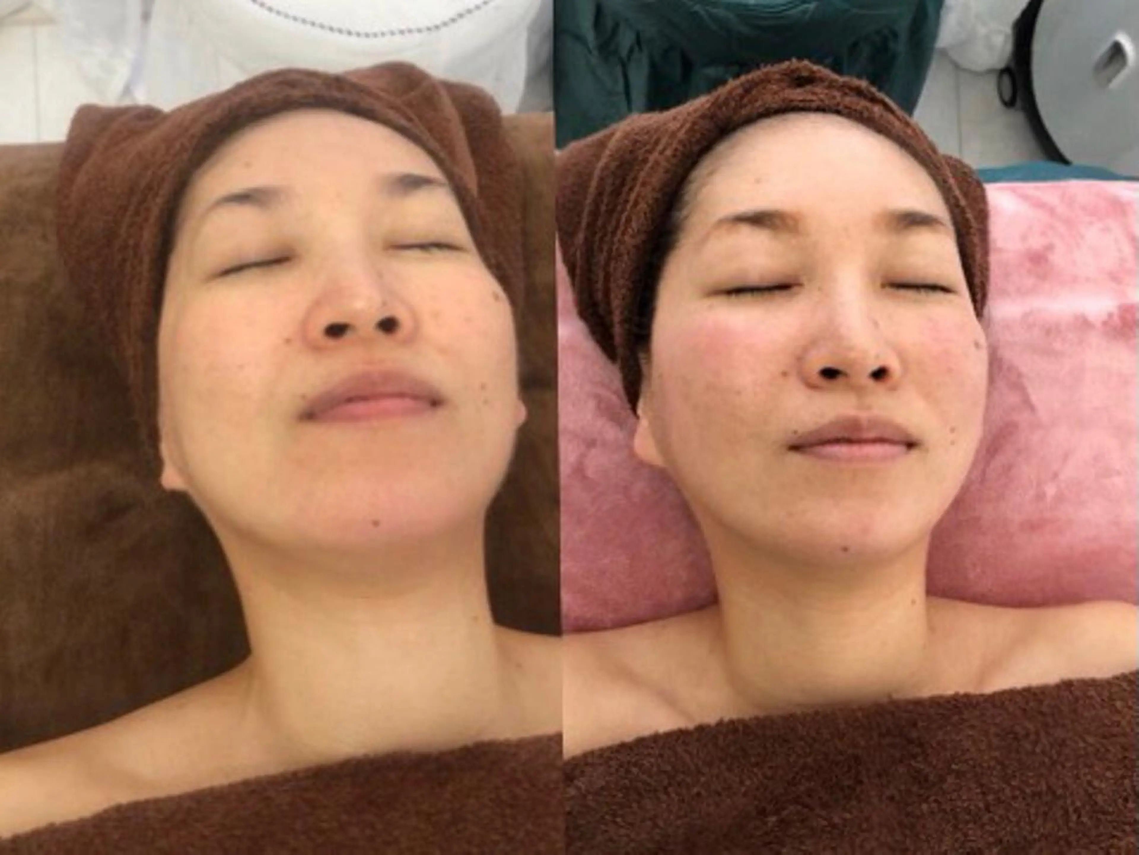 美容医療提携 サロンドシェリーのエステ・リラクイメージ