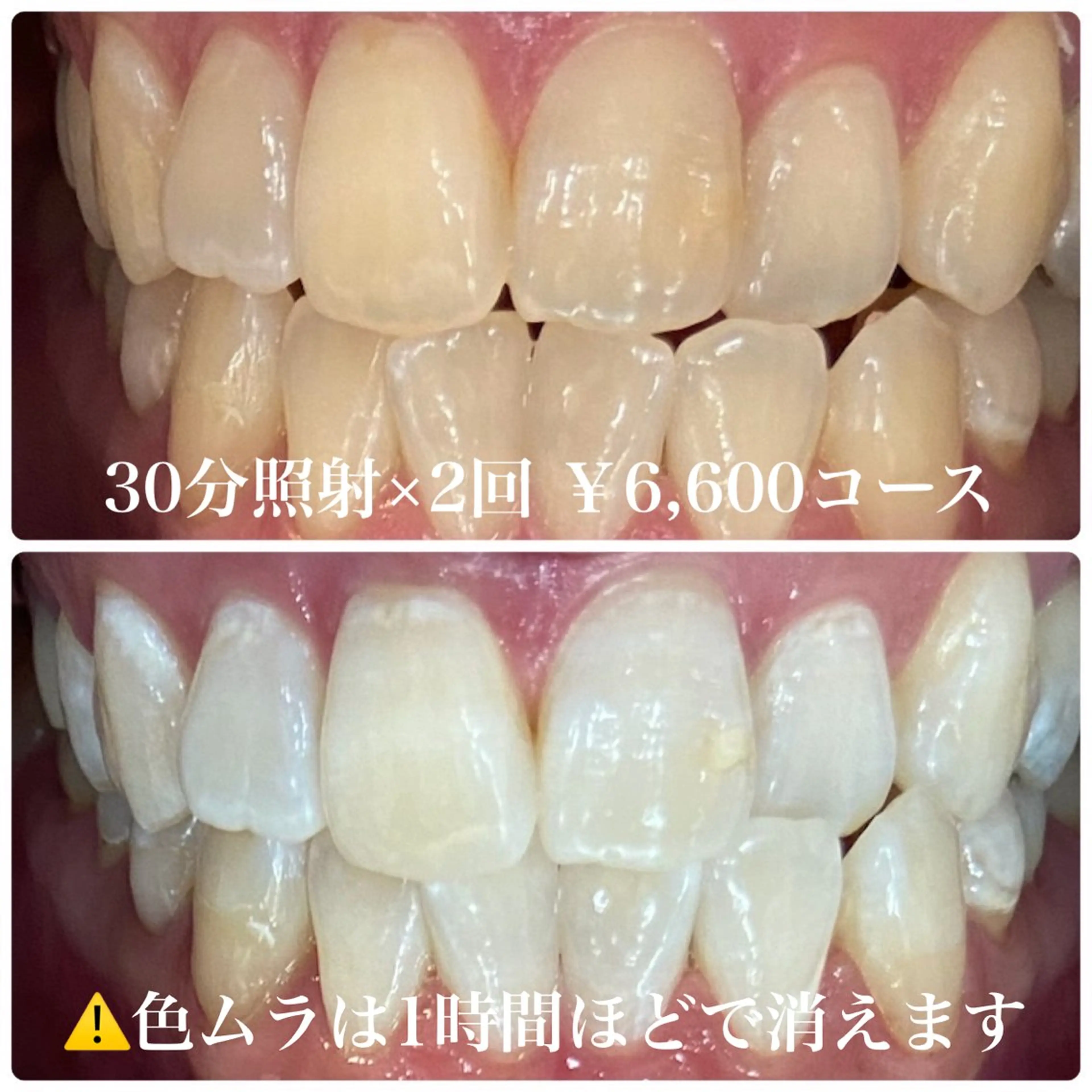 エステ PLATINUM Beauty 横浜店所属・ホワイトニングルーム 横浜店のその他イメージ