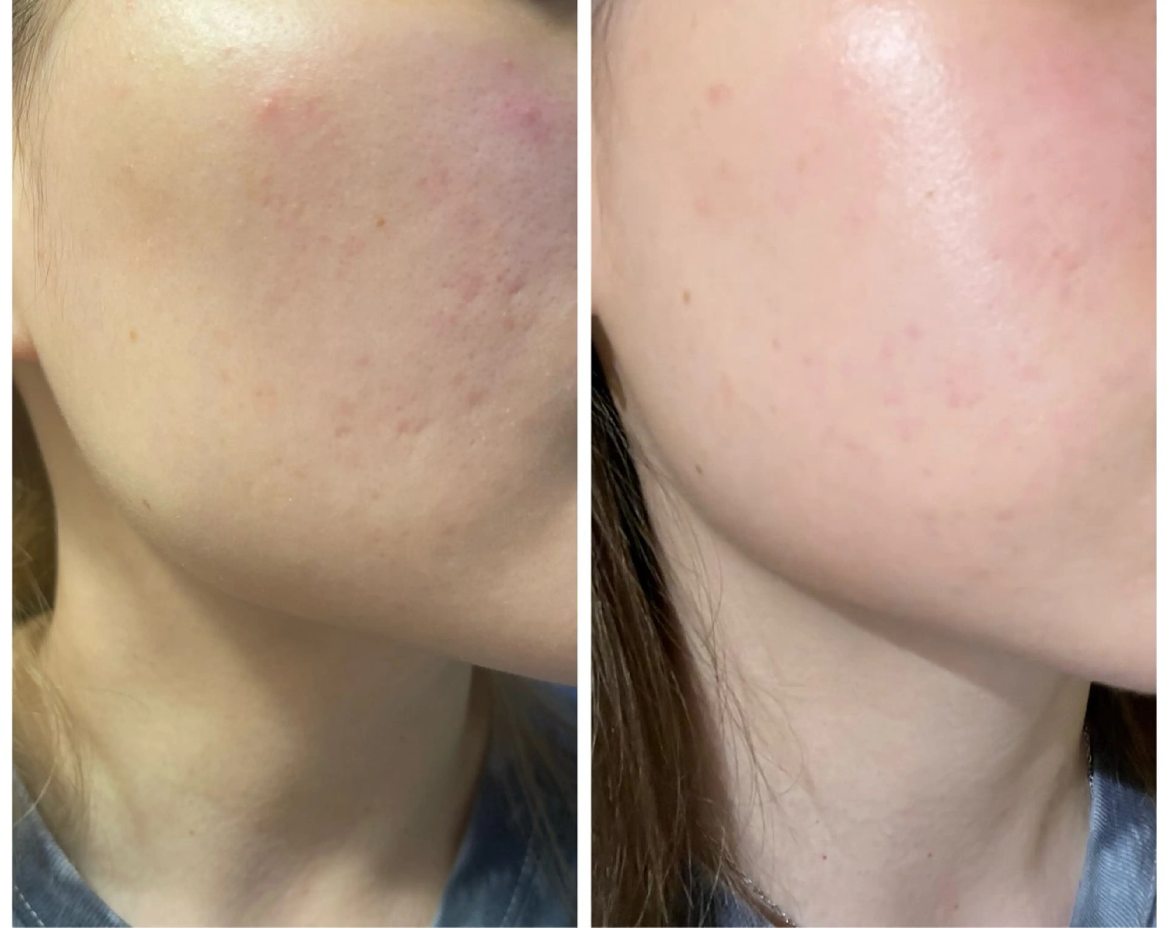 小顔/たるみ/黒ずみ除去専門サロン/SONA 大和西大寺店所属・【小顔専門看護師 サロンSONA】のエステ・リラクイメージ